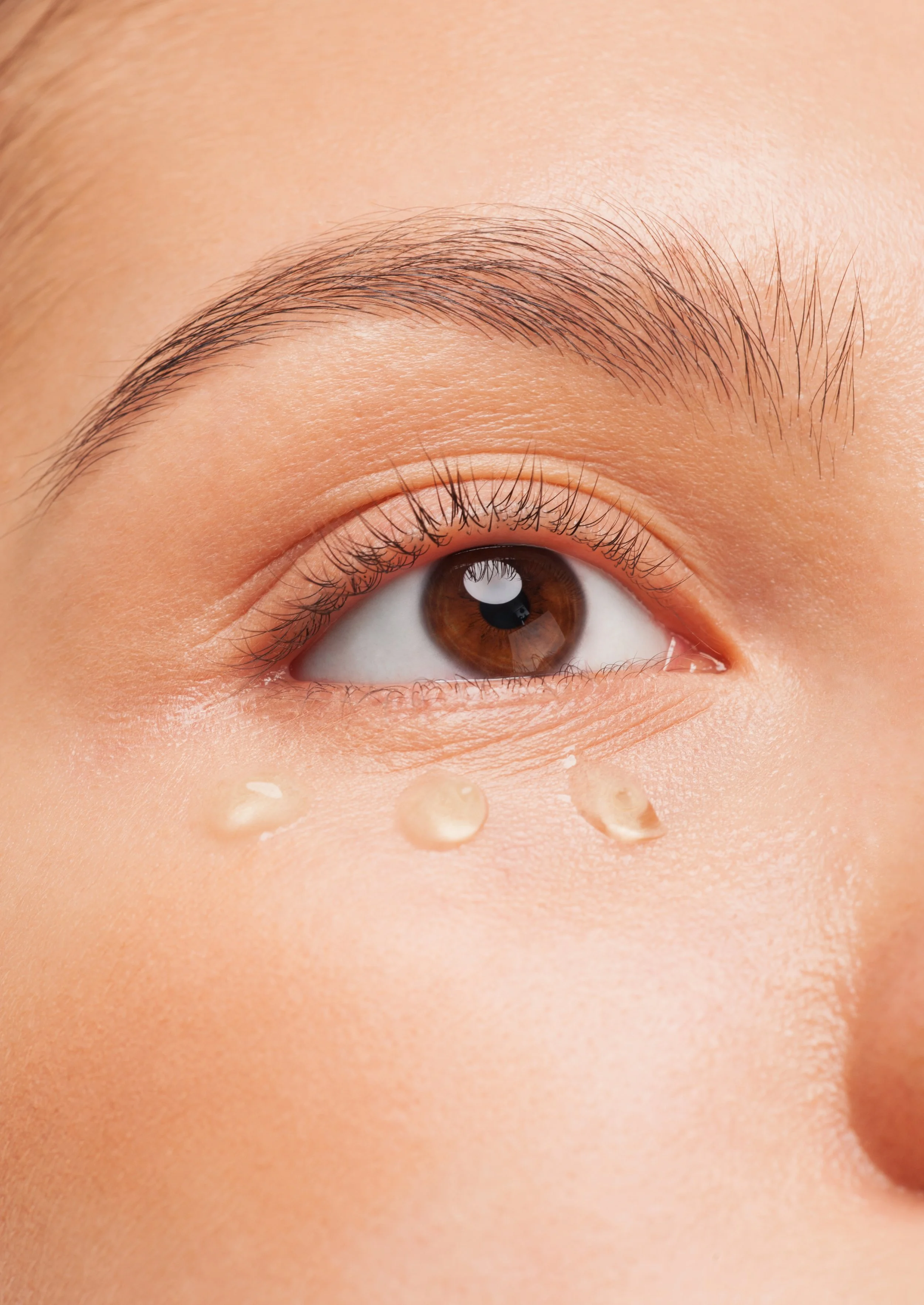 Close-up of a human eye with two drops of clear liquid on the cheek near the eye.