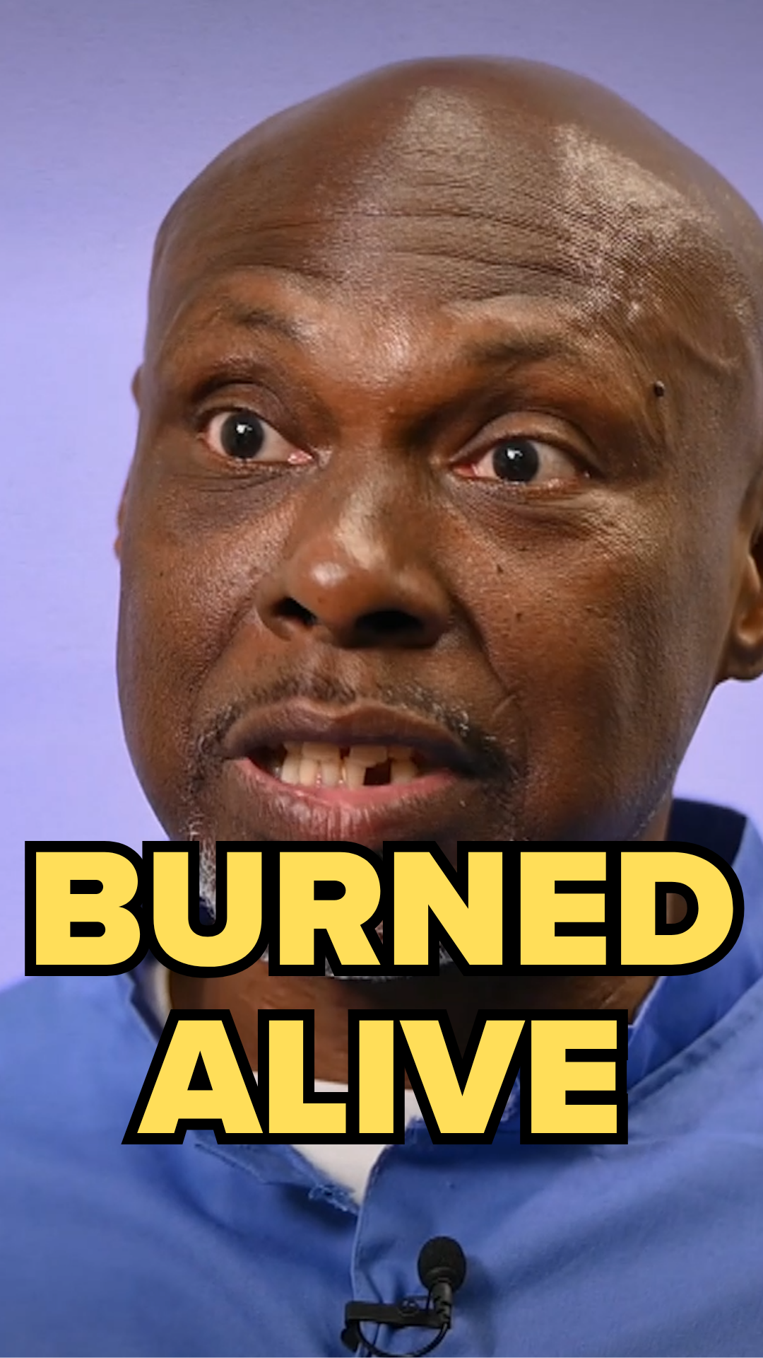 burned alive.png
