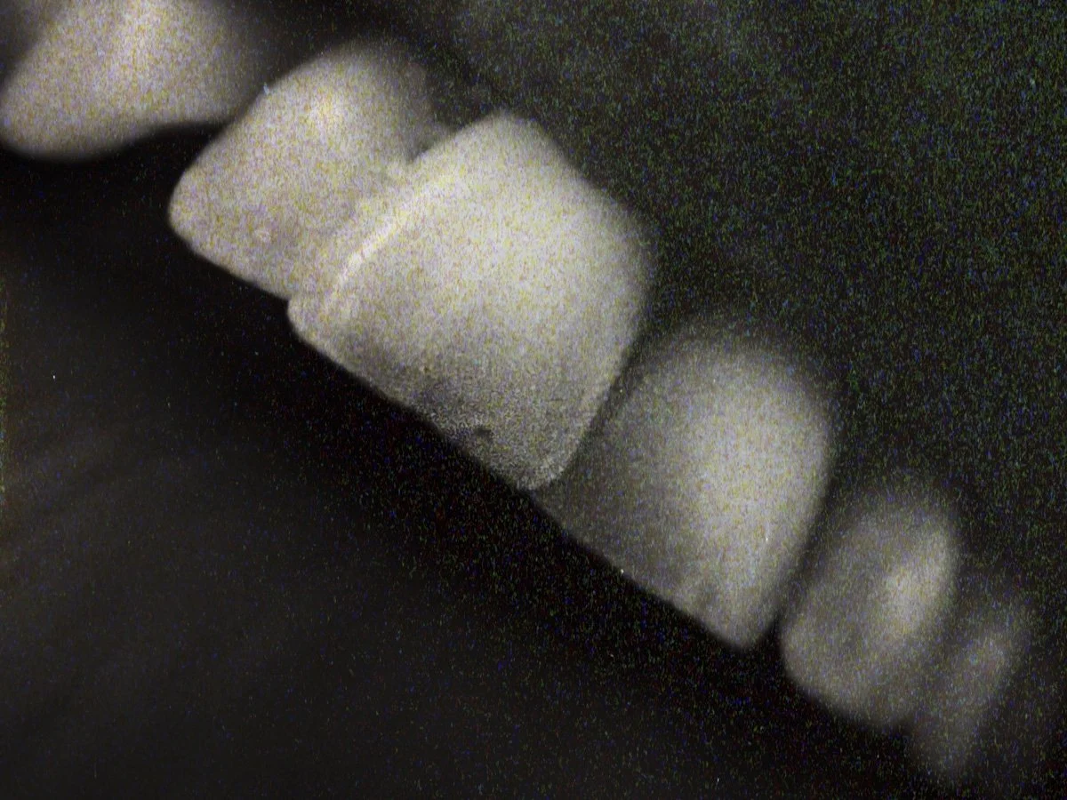 02. Dented Teeth_Finally The Sun_Olivia Mròz.jpg