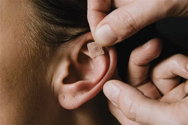 Ear Seed Therapy