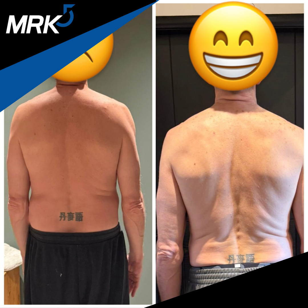 Side-by-side comparison of a man's back showing significant weight loss and improved muscle tone, with a tattoo of Chinese characters on his lower back.