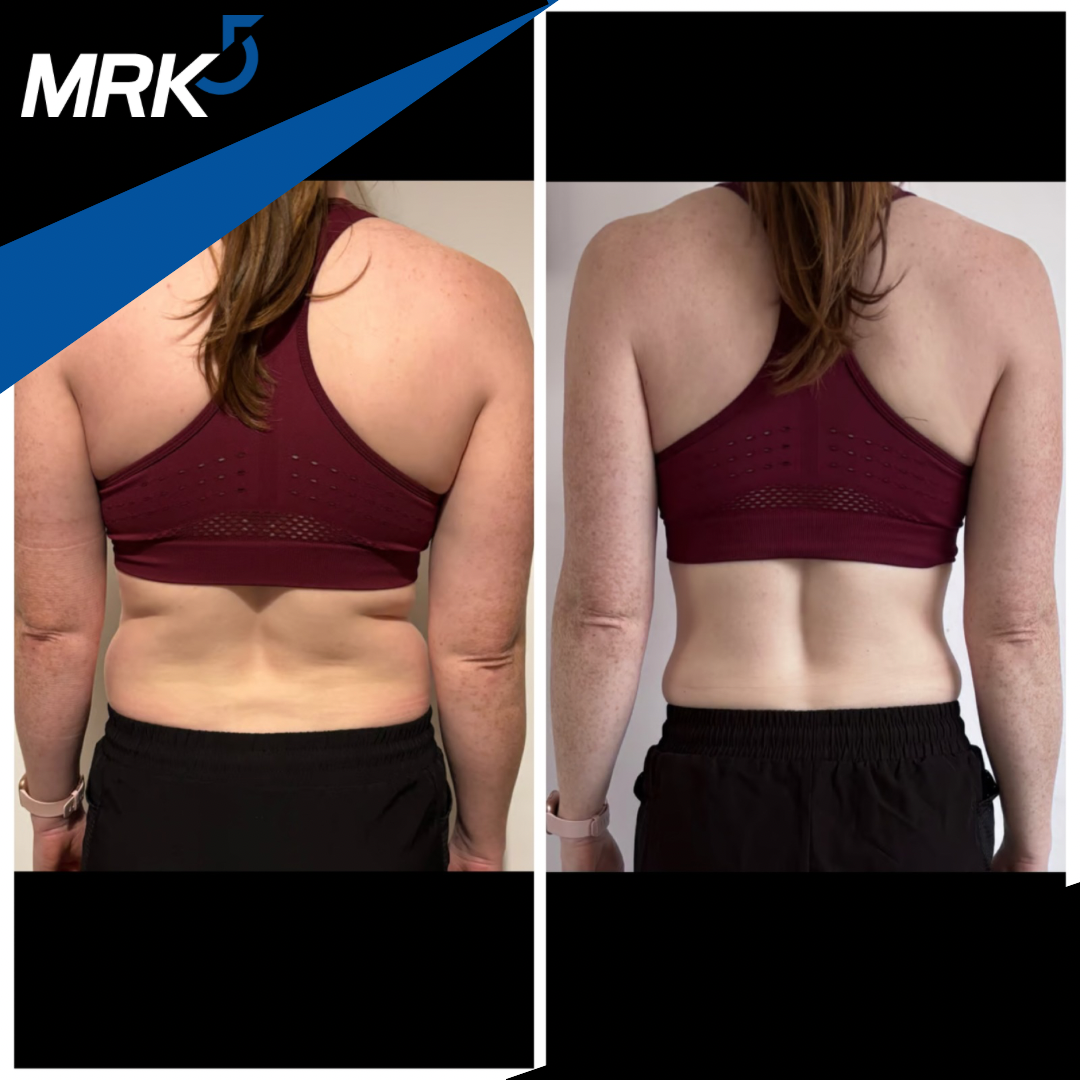 Side-by-side comparison photo of a woman with visible body fat and skin changes on the back, wearing a maroon sports bra and black shorts, illustrating physical transformation.