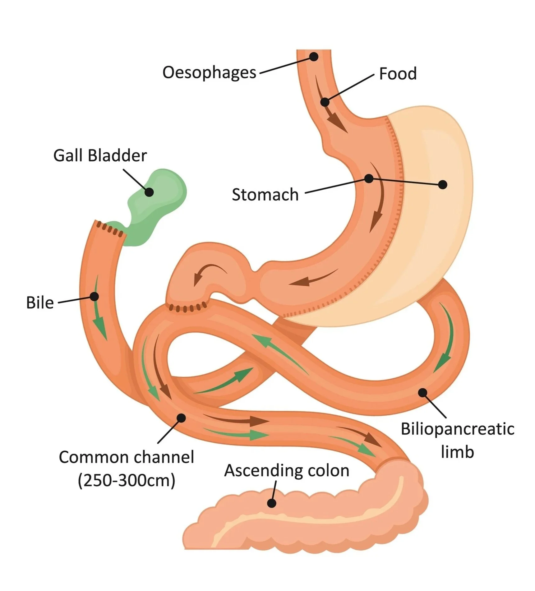 Diagram of the human digestive system highlighting the stomach, oesophagus, gall bladder, common channel, bilepancreatic duct, and ascending colon, with arrows indicating the flow of food through the digestive tract.