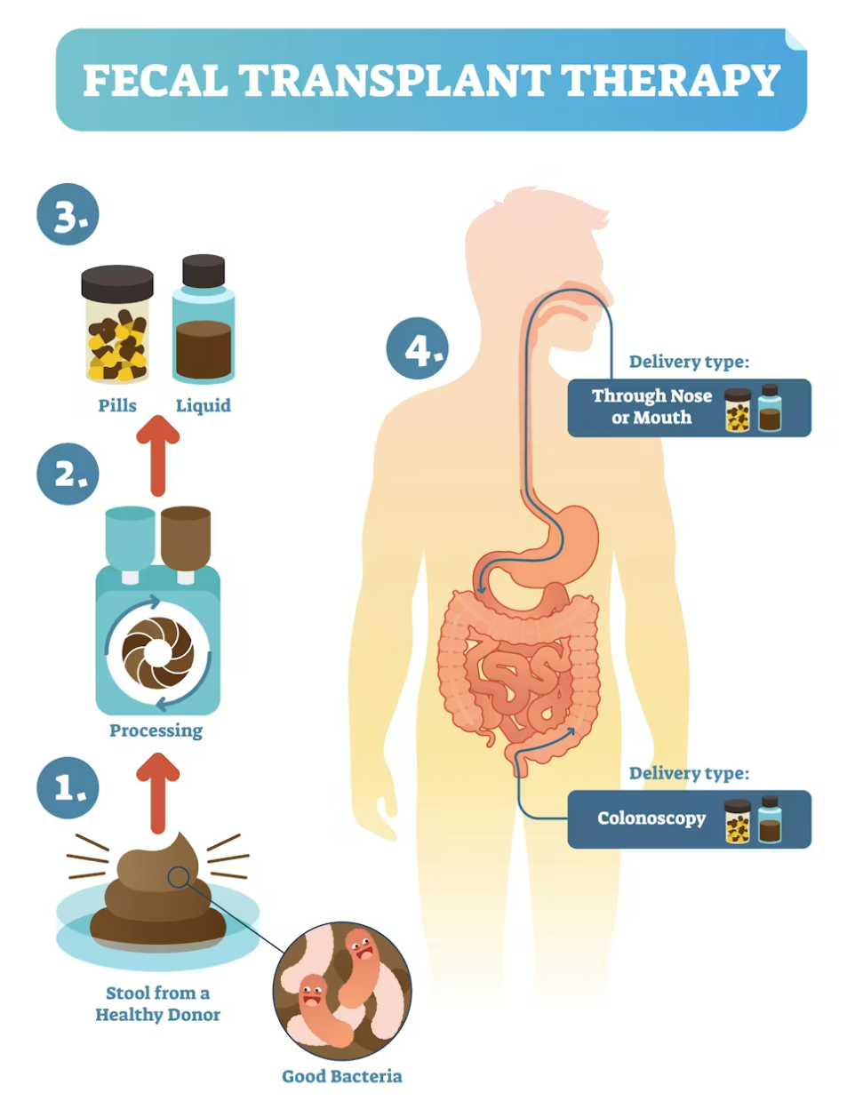 Fecal Microbiome Transplant Clinical Trials