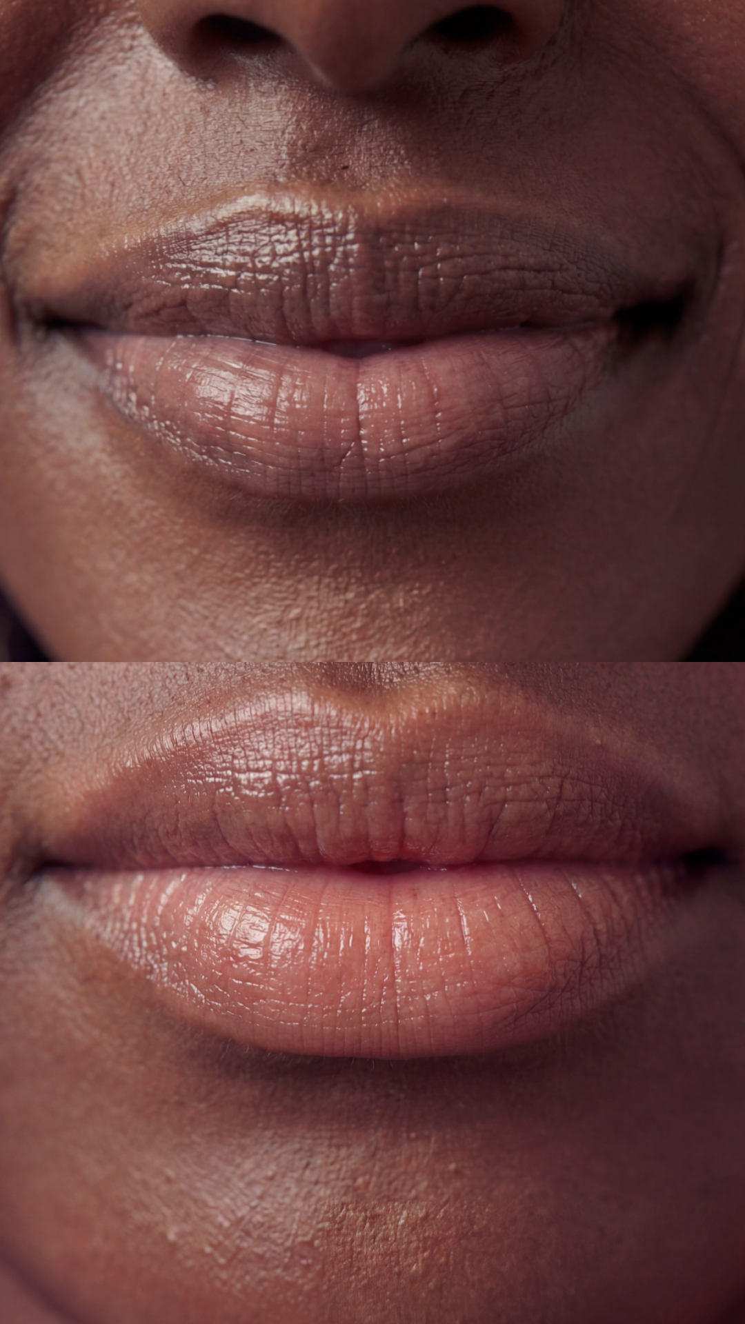 Dark lip neutralisation - colour correction and tone balancing in London