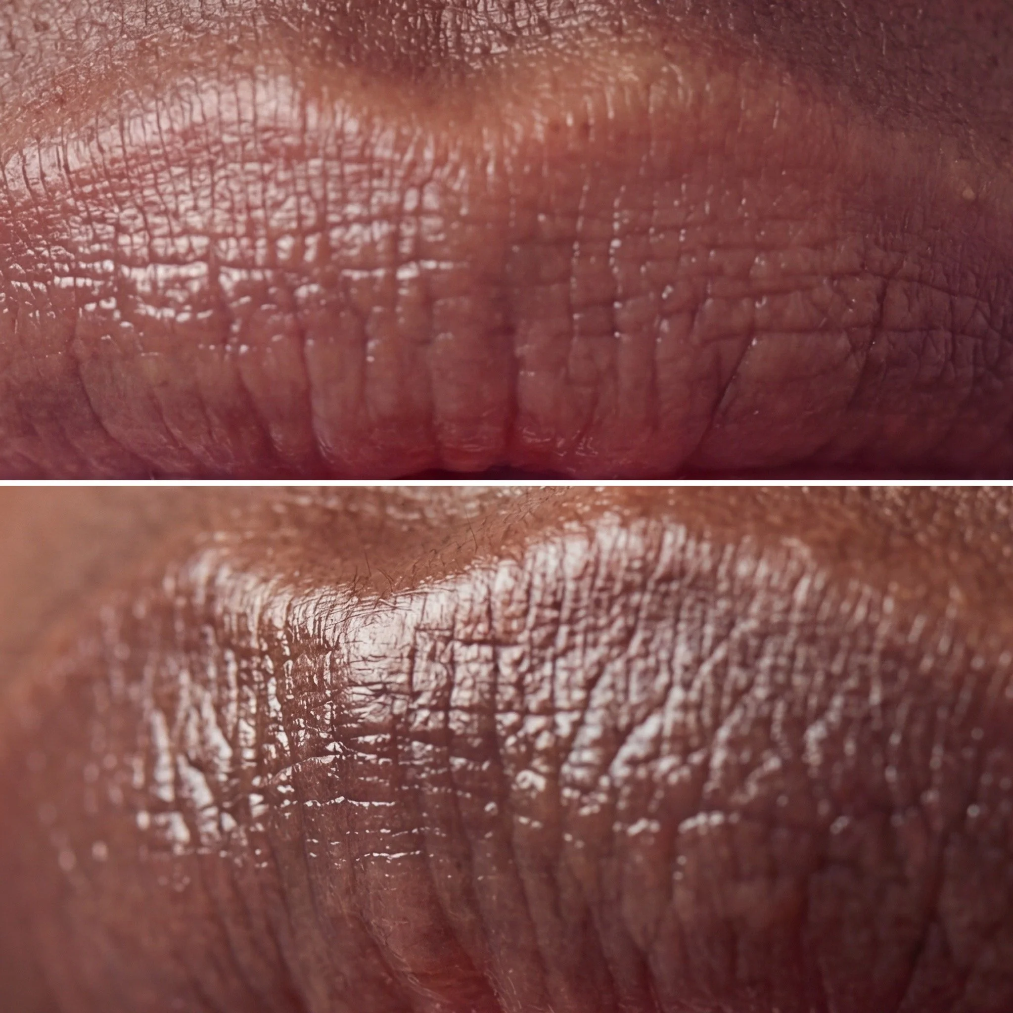 Dark lip colour correction permanent makeup before and after London