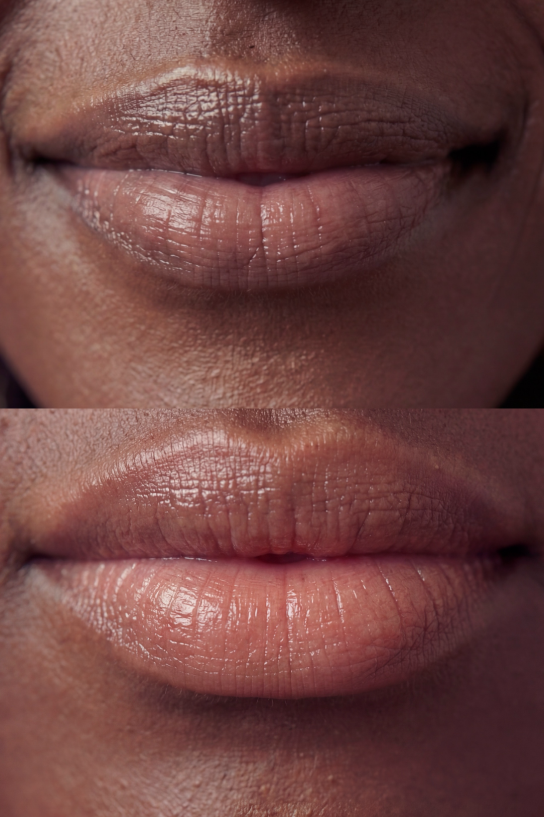 Dark Lip Neutralisation