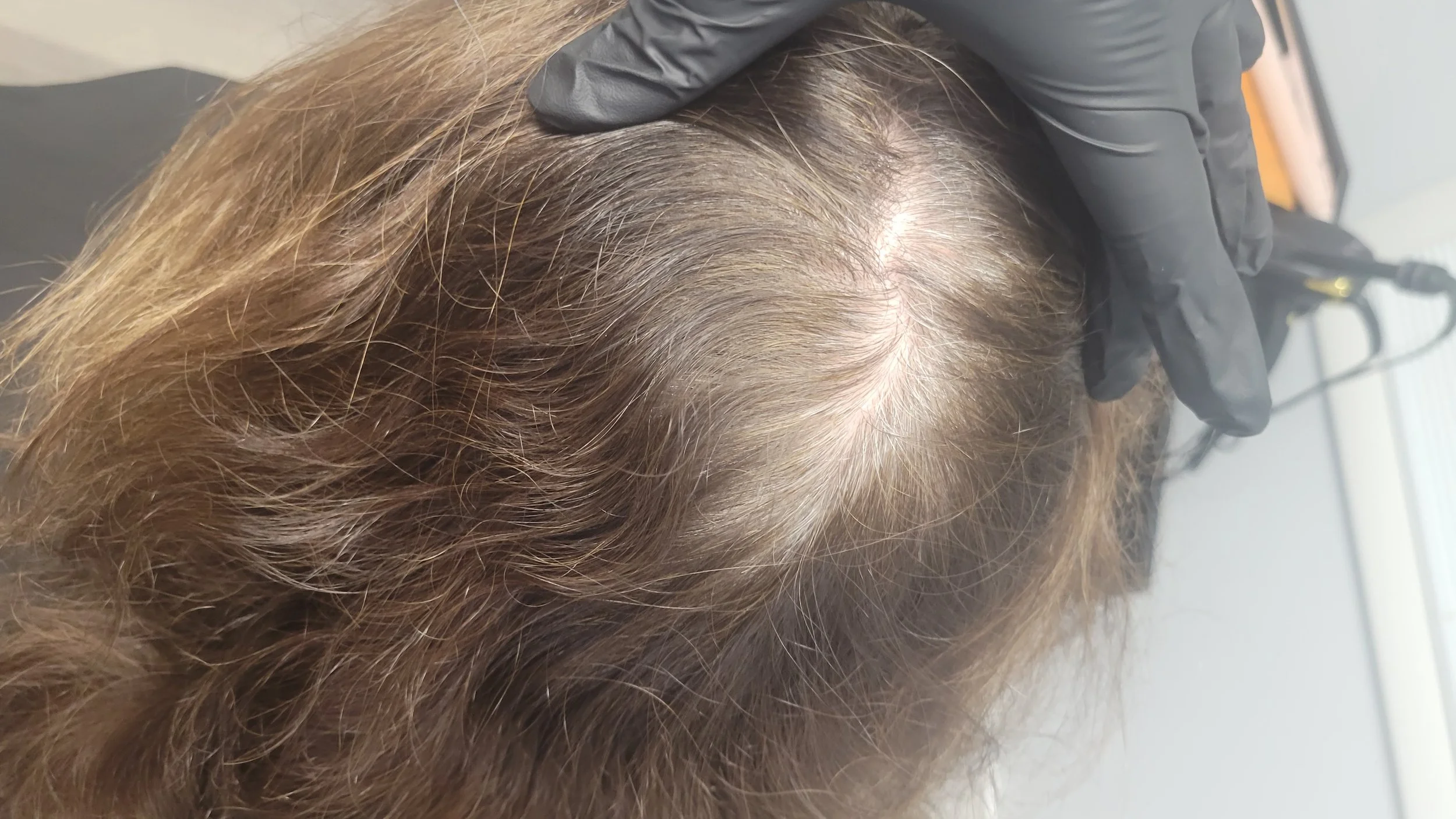 Before-gray coverage