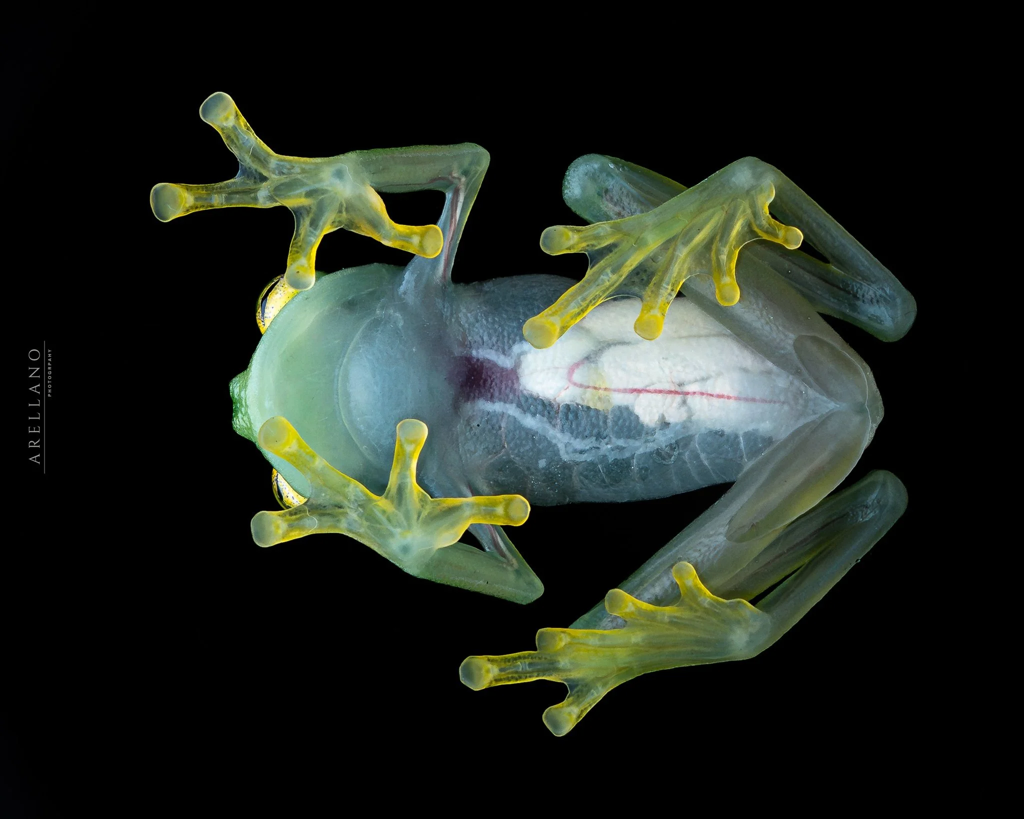 Close-up of a transparent human heart model with yellow and green details, with focus on the aortic arch and major arteries, set against a black background.