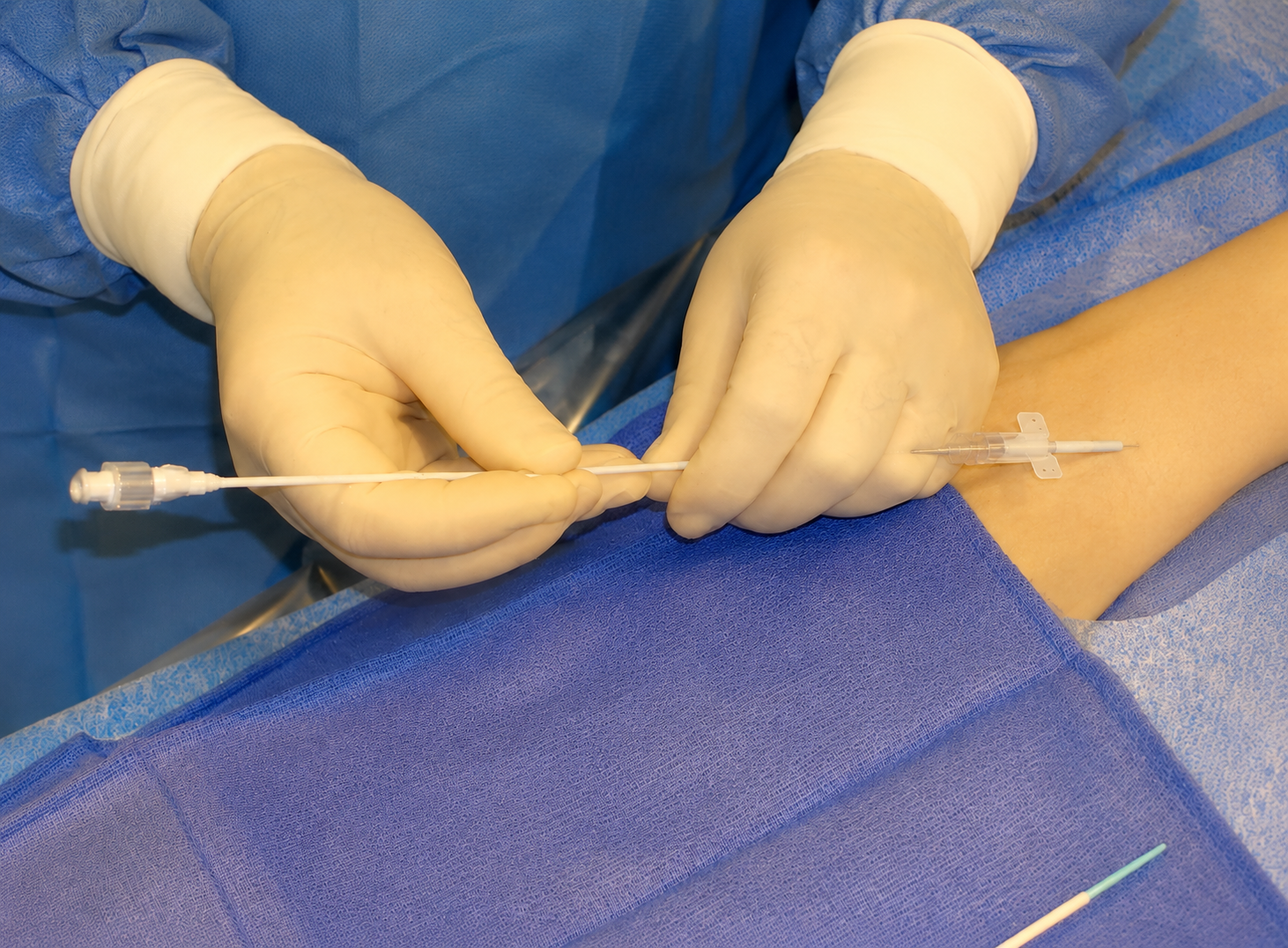 Medical professional wearing gloves inserting a needle into a patient's arm for an injection or blood draw, with medical equipment and blue drapes surrounding the procedure.