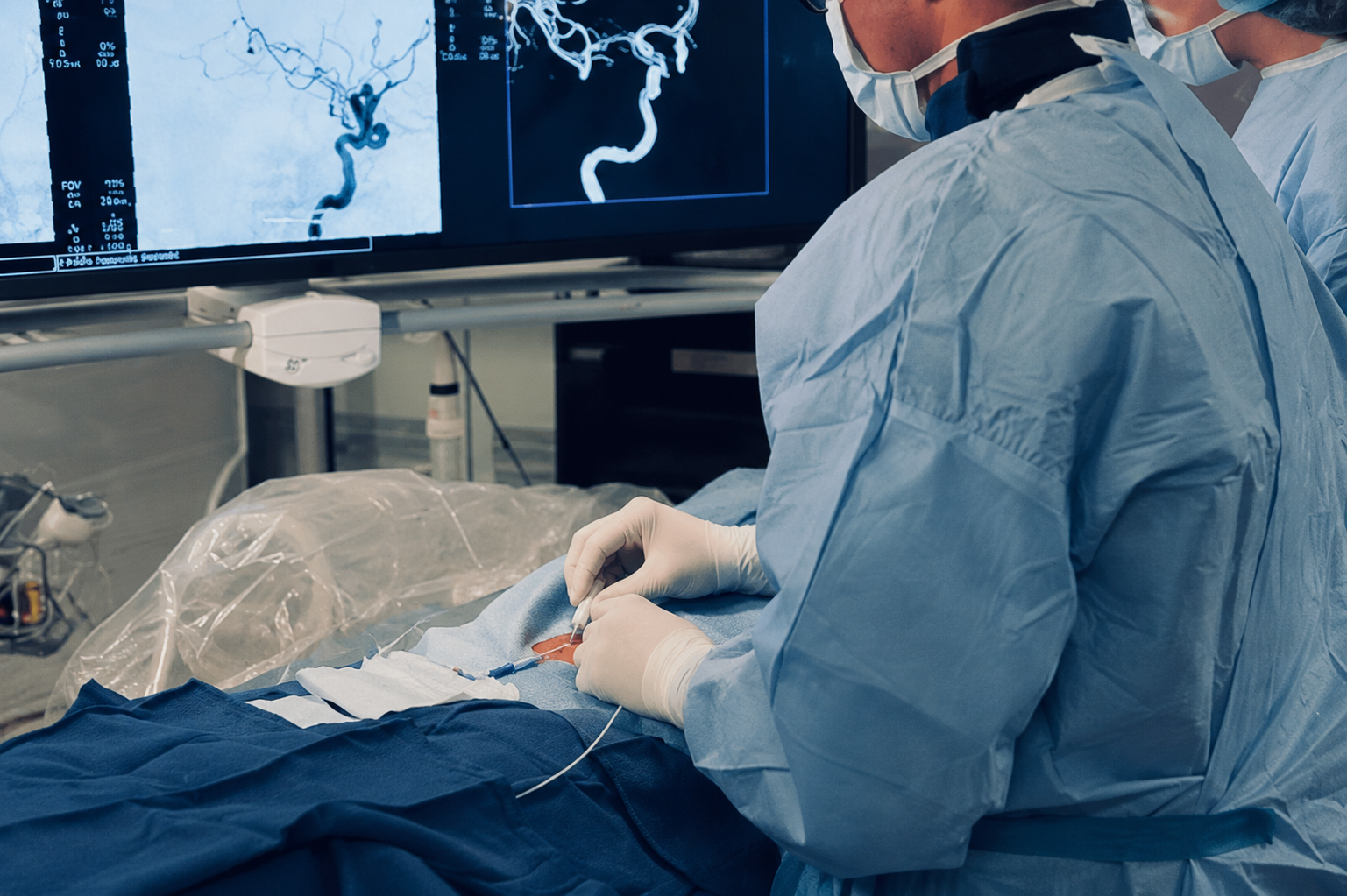 Medical team performing an angiogram procedure with brain/vascular images displayed on monitor screens.