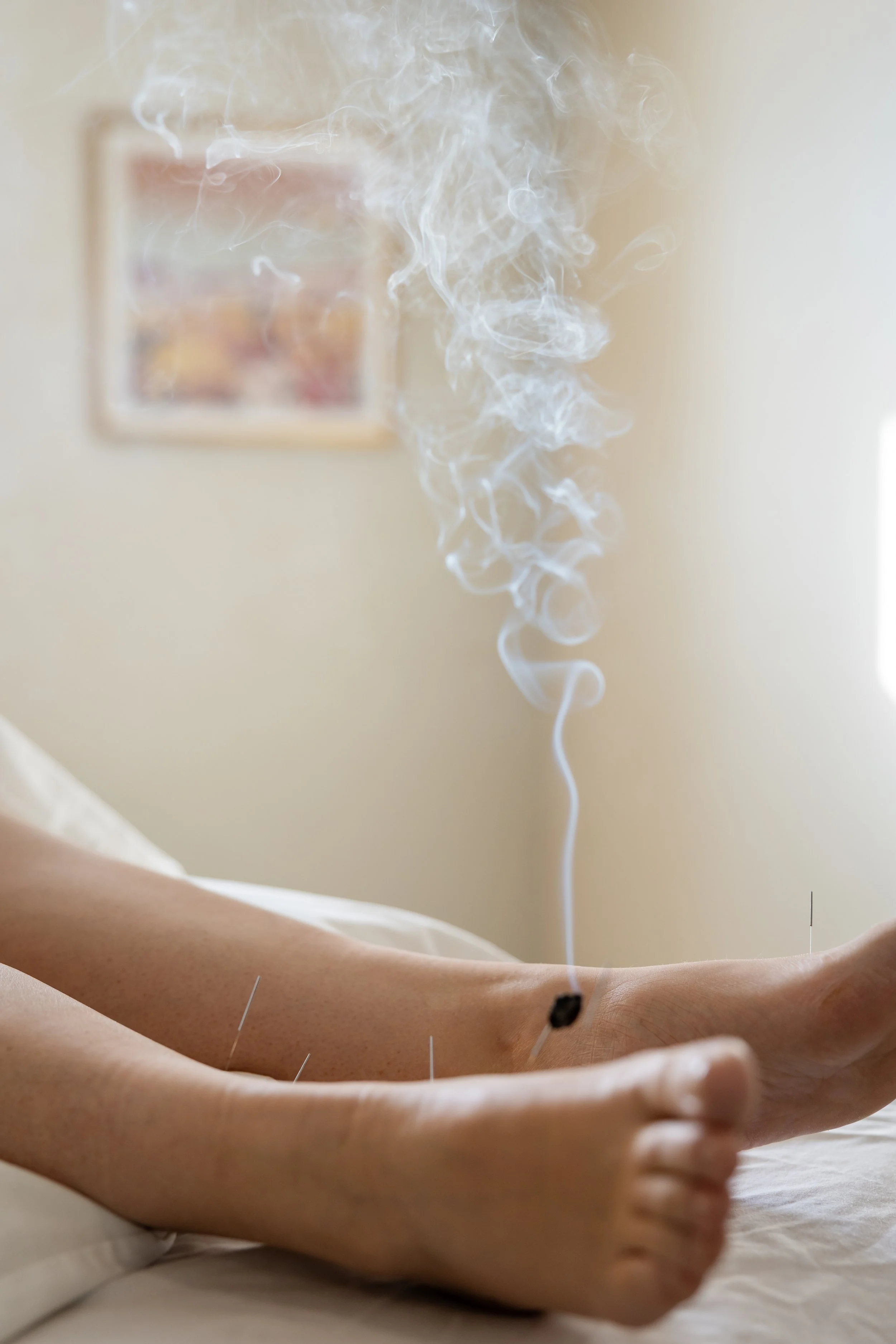 Acupuncture Herbal Chinese Eastern Medicine  Casper Wyoming Moxa