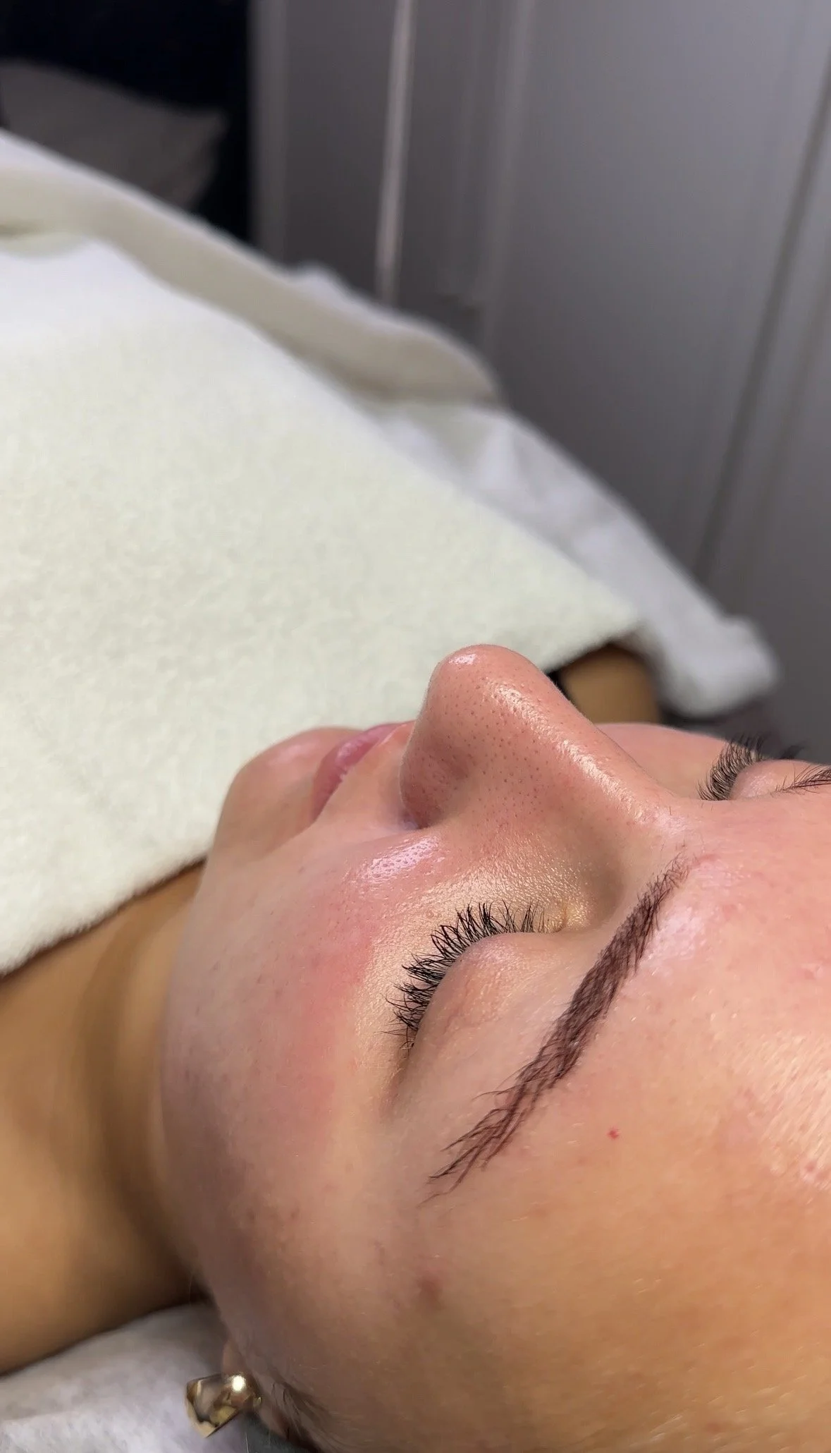En person ligger ner med stängda ögon på en medicinsk eller spa-behandlingsbädd, omgiven av en klinisk miljö.