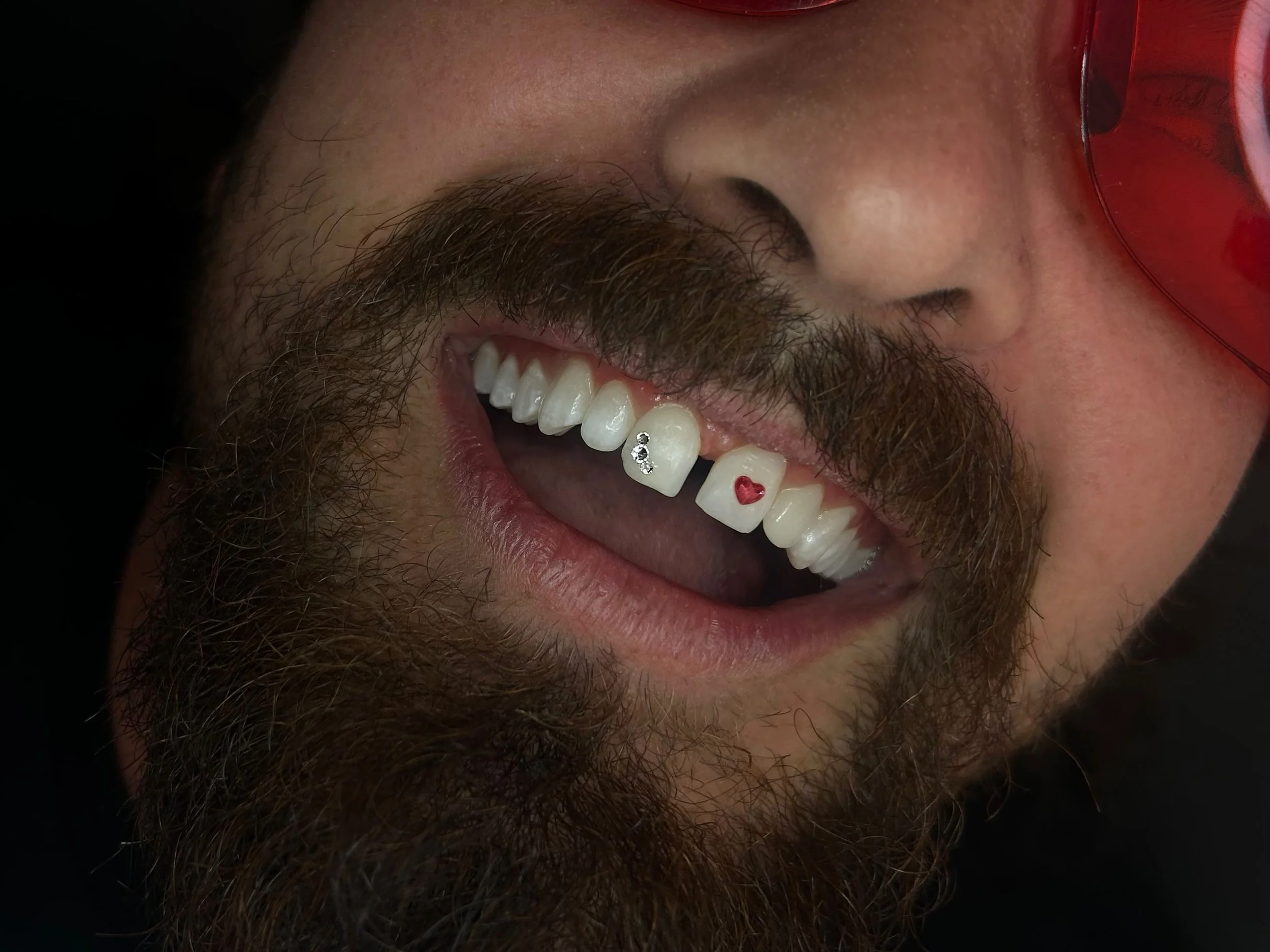 Close-up of a smiling man with a beard, showing his teeth decorated with small rhinestone embellishments, and wearing red glasses.
