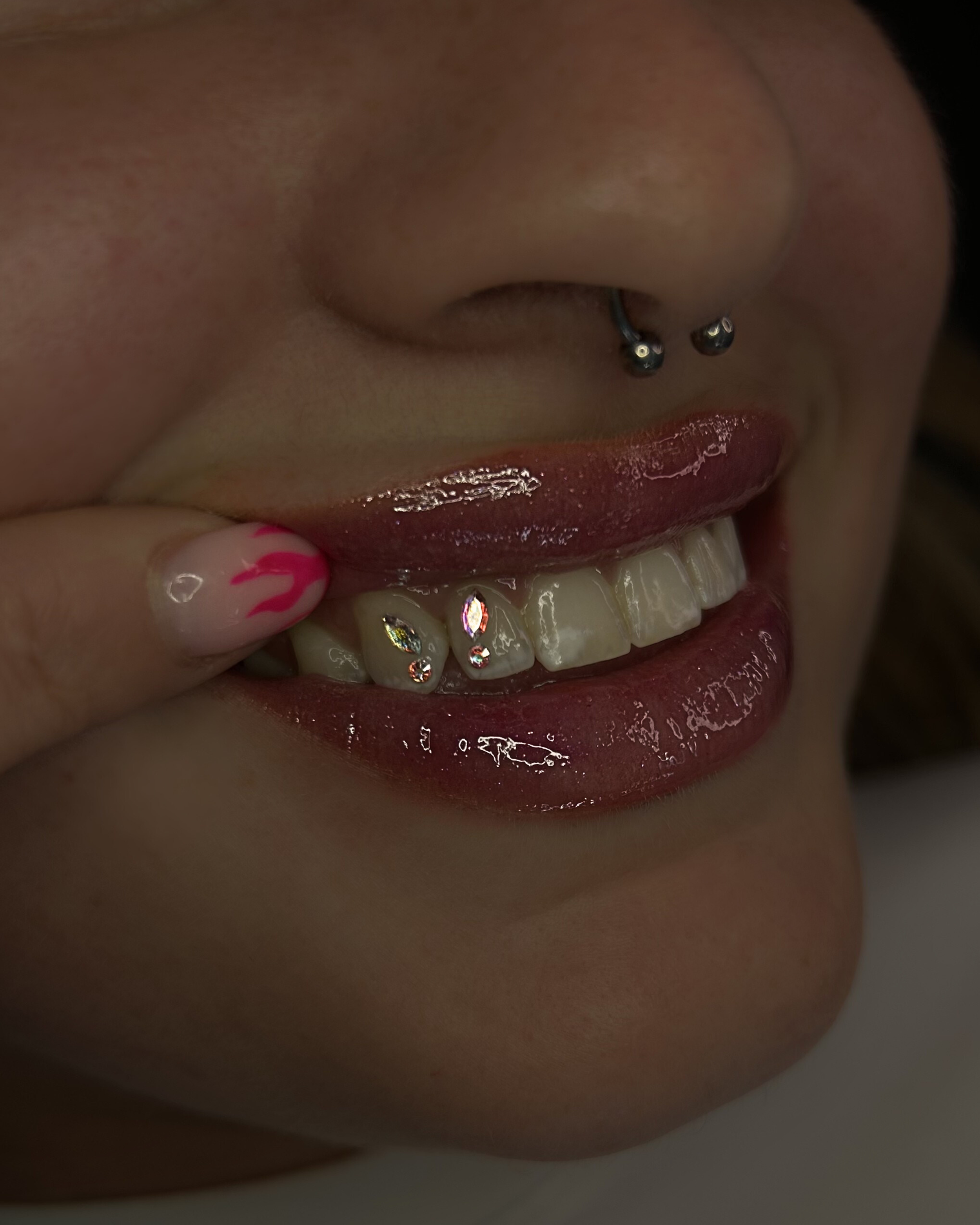 Close-up of a person's face showing their nose, mouth with shiny lips, and teeth with rhinestones. The person is holding their face with fingers decorated with pink nail polish and designs.