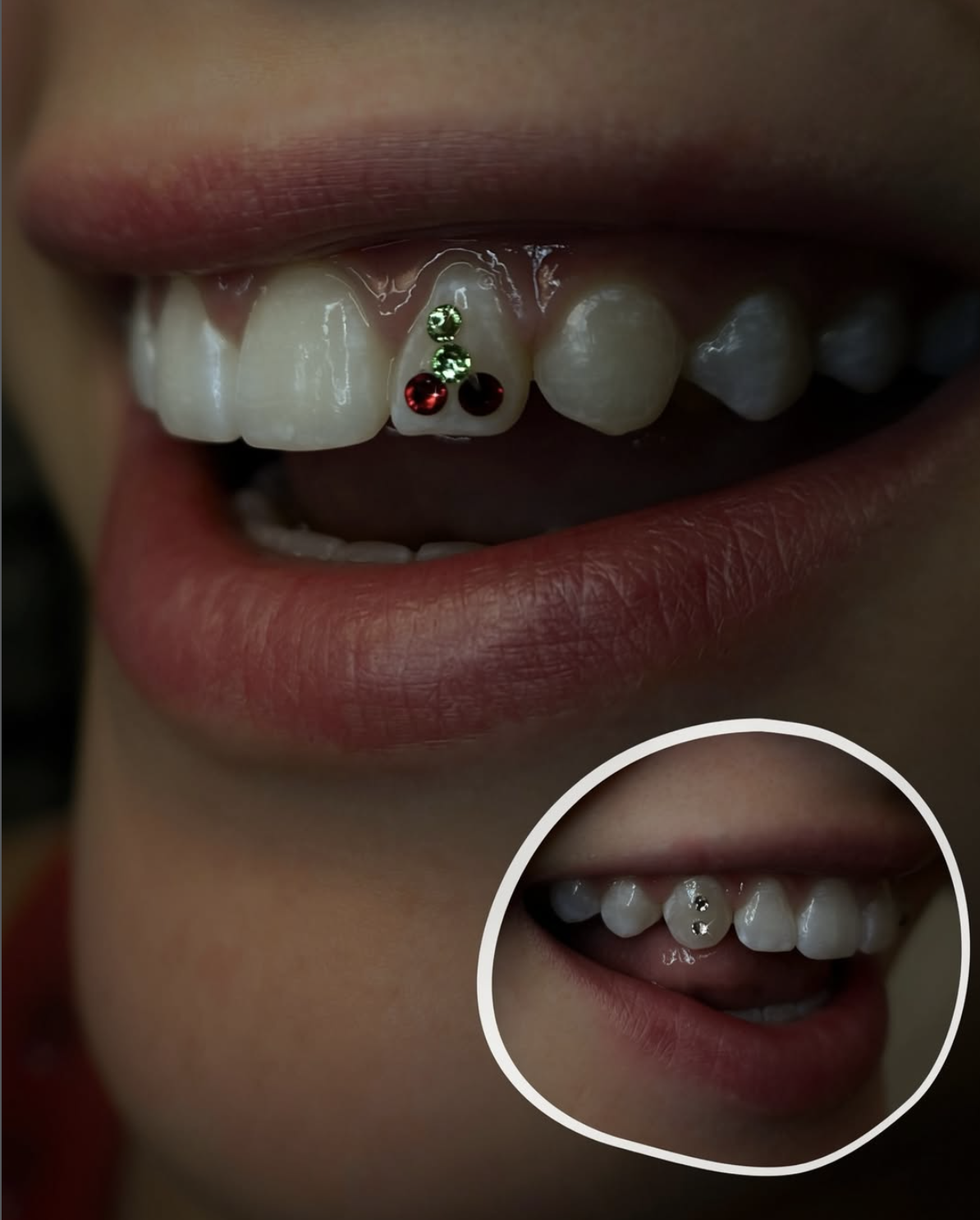 Close-up of a child's mouth showing baby teeth, with some decorated with colored rhinestones, and a smaller inset image of the same child's mouth with a different set of rhinestones.