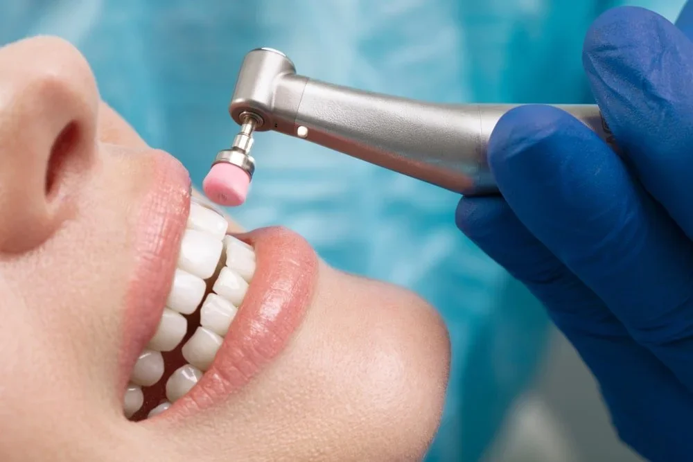 Close-up of a dental cleaning procedure where a dental professional uses a small electric tool with a pink rubber tip to clean a patient's teeth. The patient's mouth is open, showing white teeth and lips, and the dental professional is wearing a blue glove.