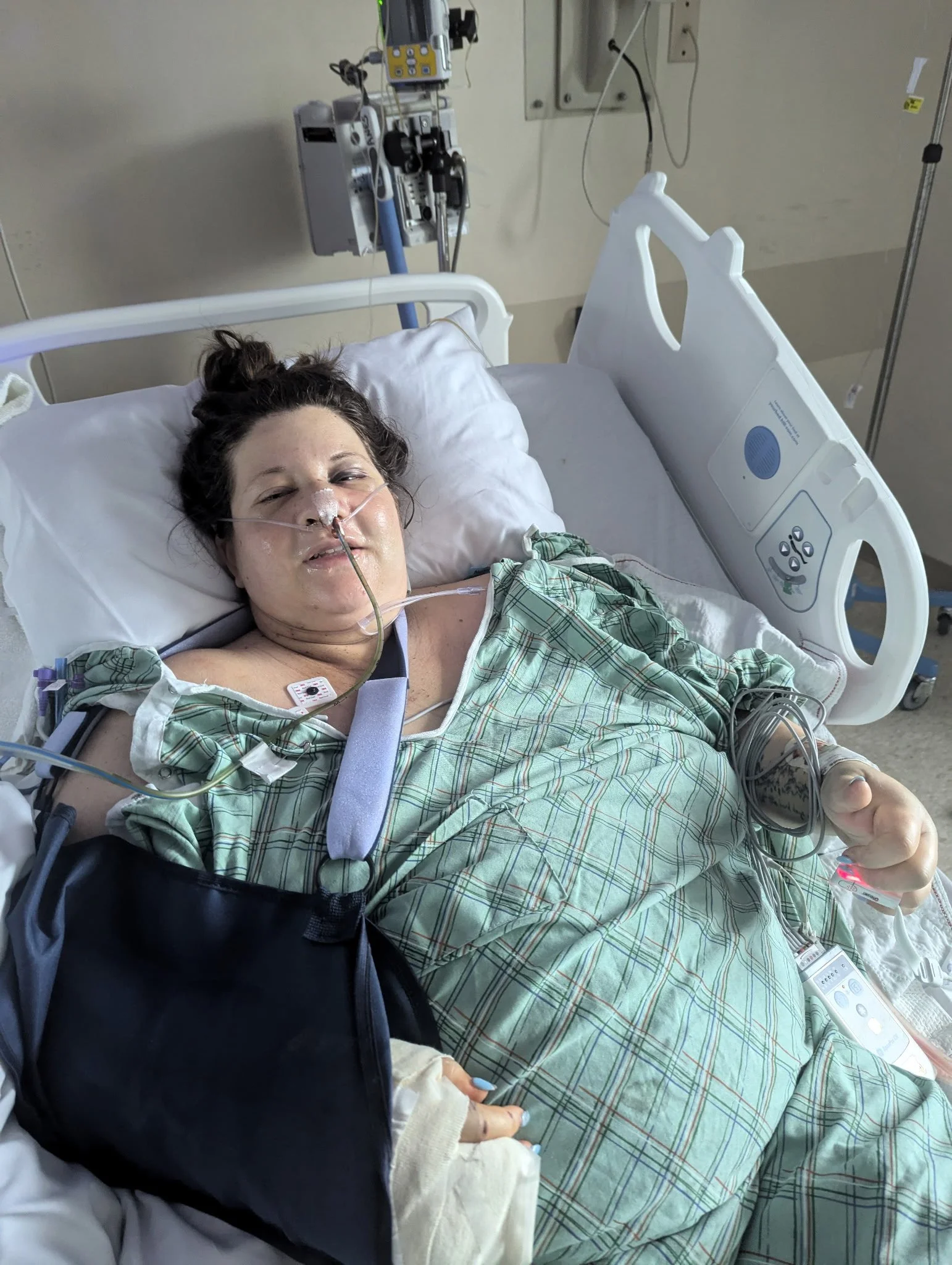 A woman lying in a hospital bed connected to medical devices, with a nasal tube and an IV, in a hospital room.