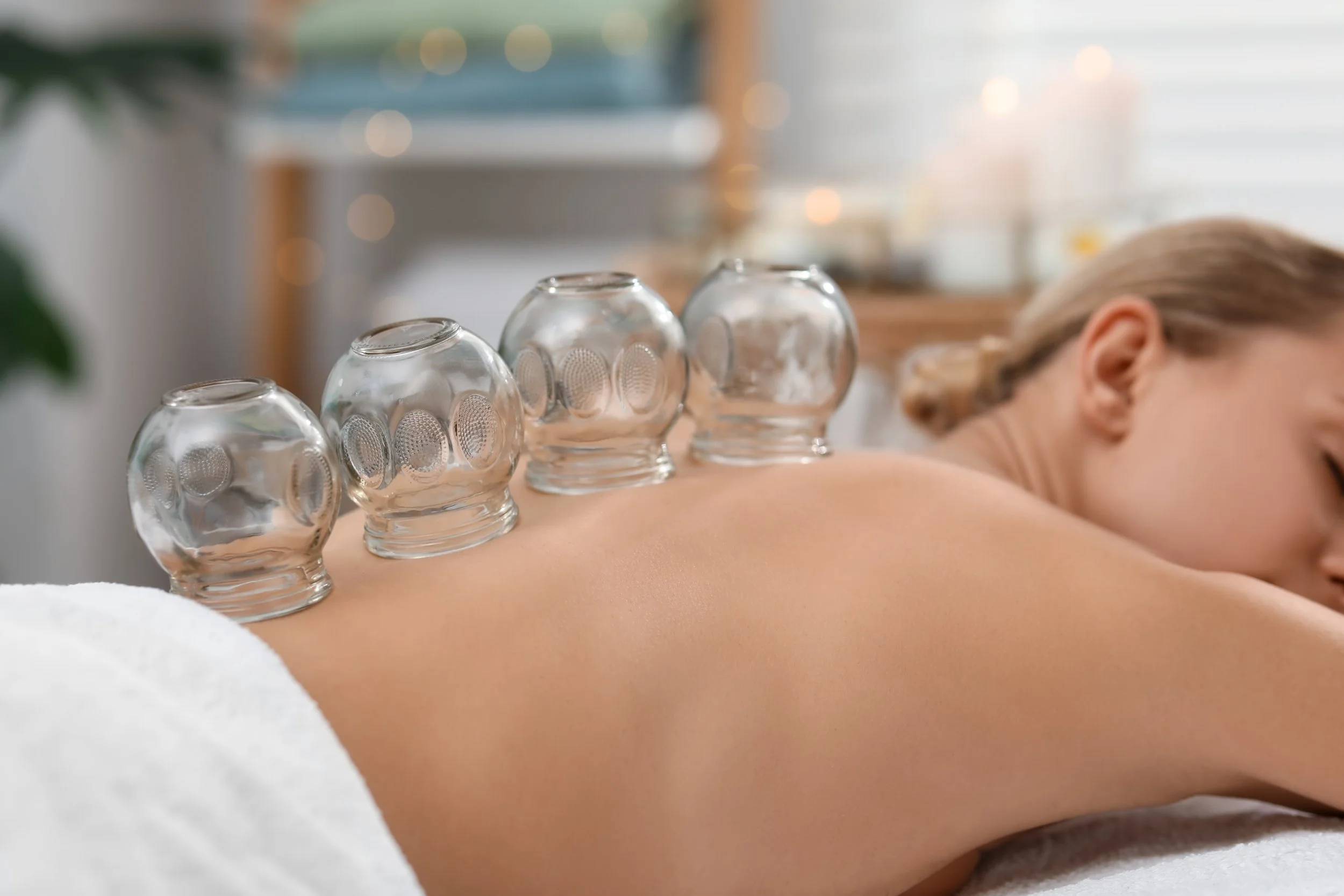 Nahaufnahme einer Rückenseite einer Person, die eine Massage erhält, mit mehreren kleinen, runden, transparenten Glasgefäßen auf dem Rücken, wahrscheinlich für Gua Sha oder eine ähnliche Behandlung.
