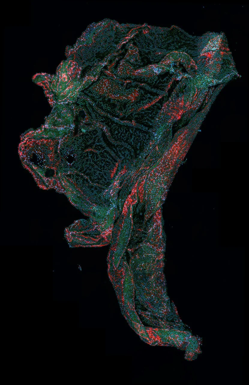 Microscopic image of tissue with green, red, and blue fluorescent dots on a black background.
