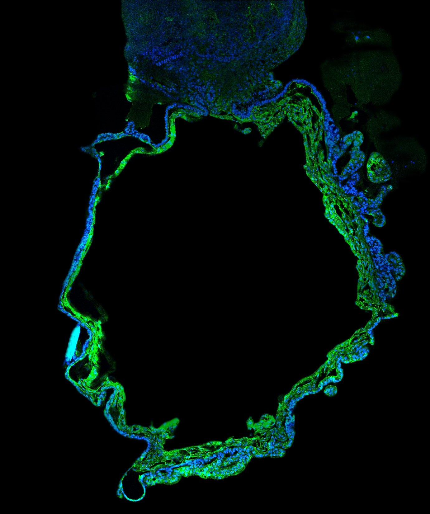 Microscopic view of nerve cells in blue and green with a dark background.