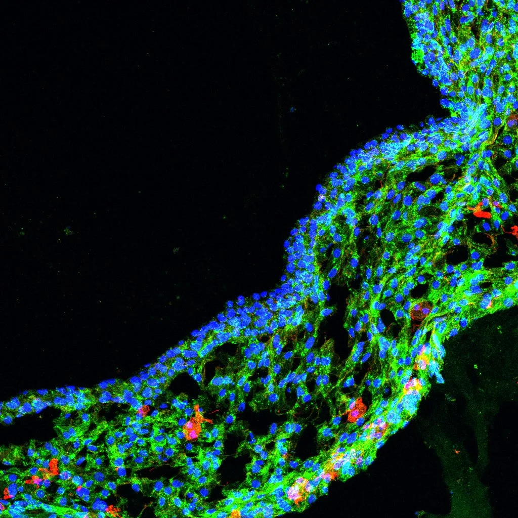 Microscopic image of a biological tissue sample with blue-stained nuclei, green-stained structures, and red highlights against a black background.