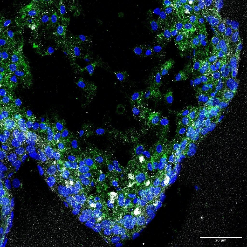 Microscopic view of a heart-shaped cluster of cells stained with blue and green dyes on a black background, with a scale bar indicating 50 micrometers.