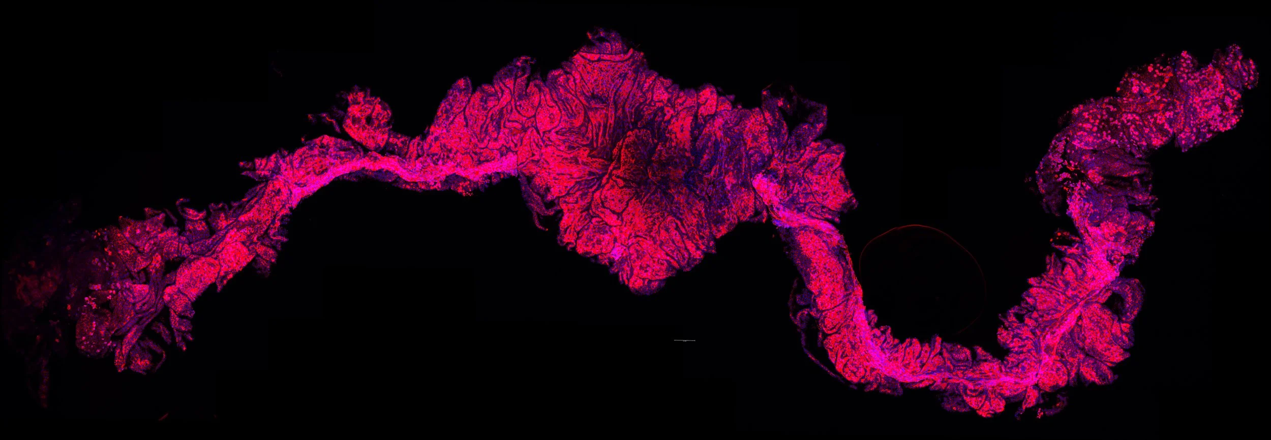 A fluorescent microscopy image of a biological tissue sample with pink and purple structures on a black background, showing detailed cellular patterns.