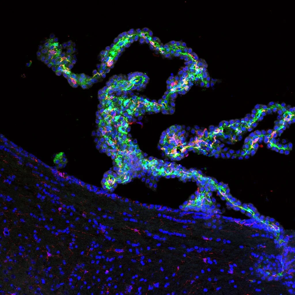 Microscopic view of a biological structure with fluorescent green, blue, and pink coloring on a black background.