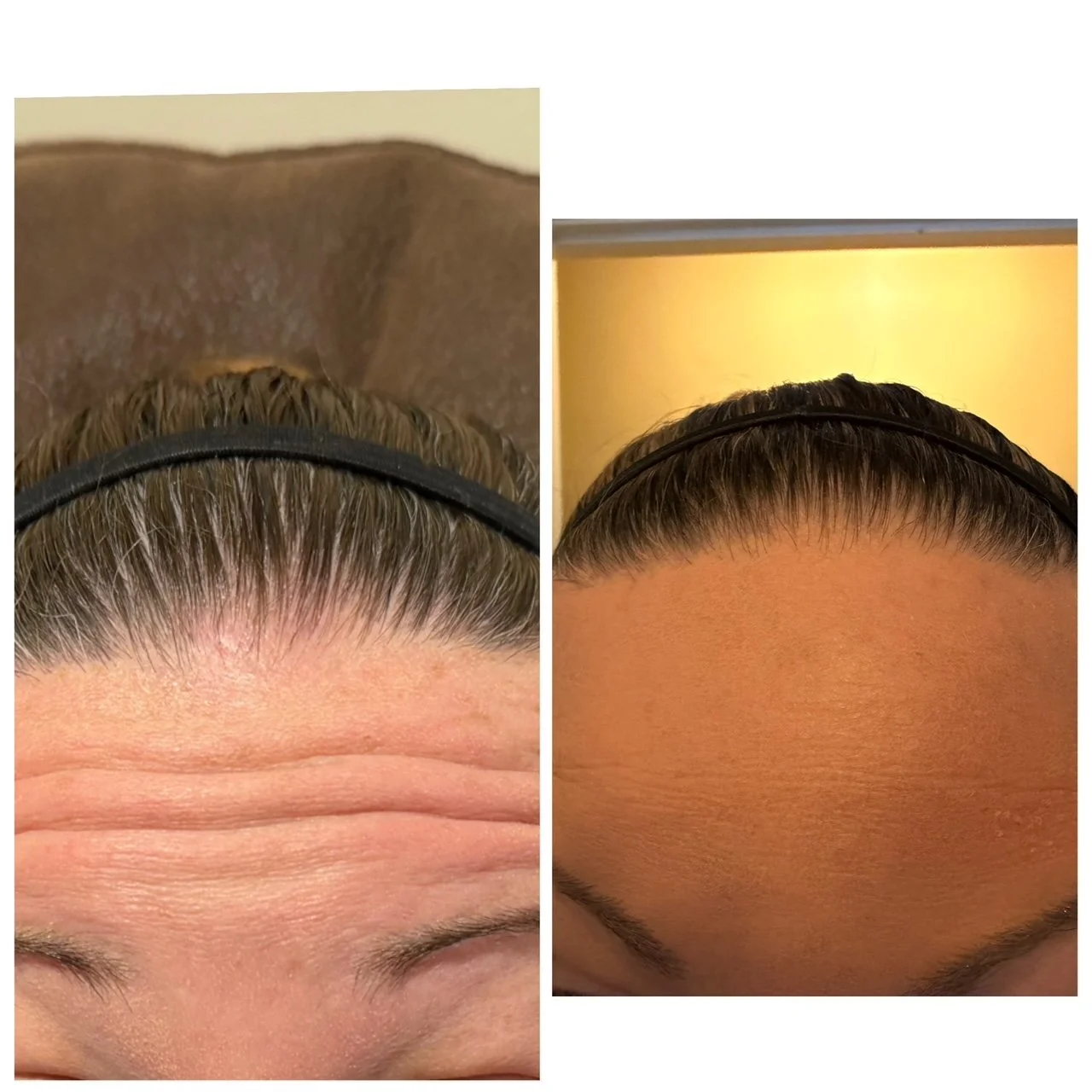 Walpole WA, 2081, Med Spa Near Me.JPG