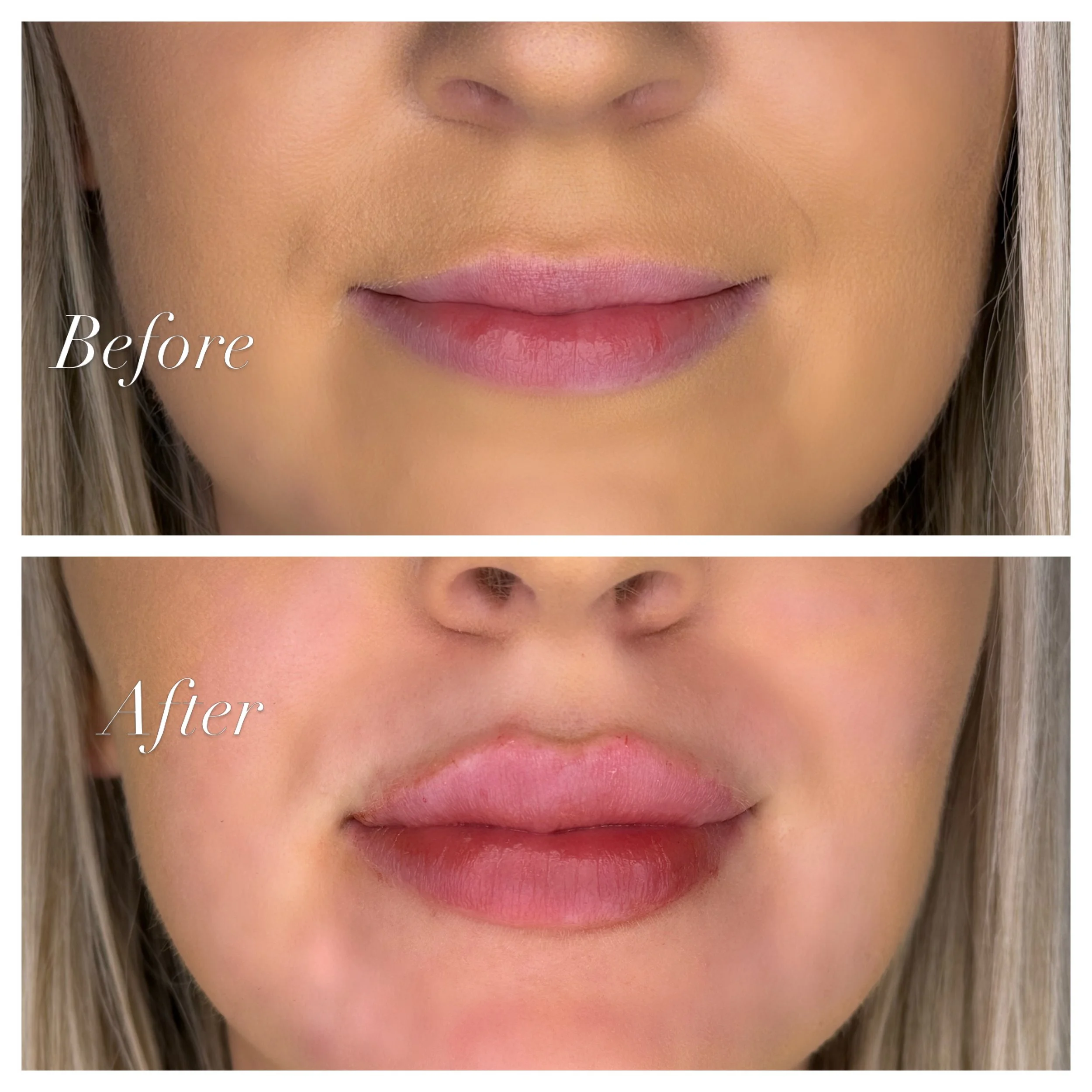 Walpole, WA 2081, Med Spa Near Me.JPG