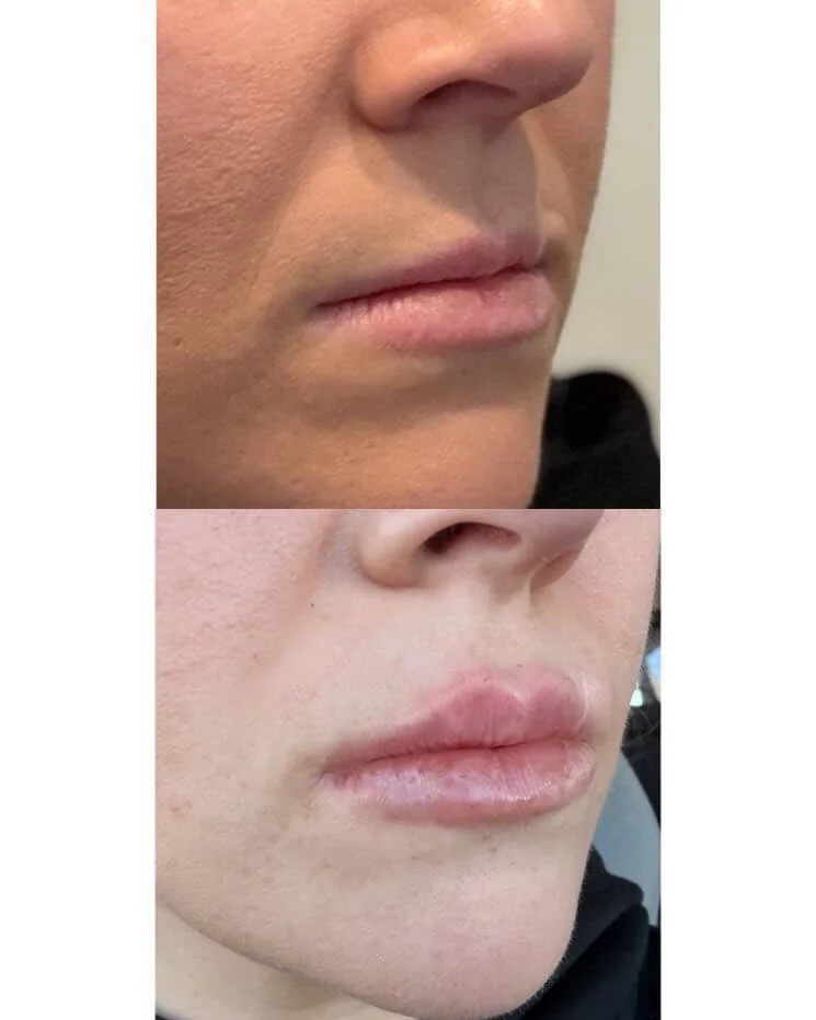 Walpole, WA, 2081, Med Spa Near Me.JPG