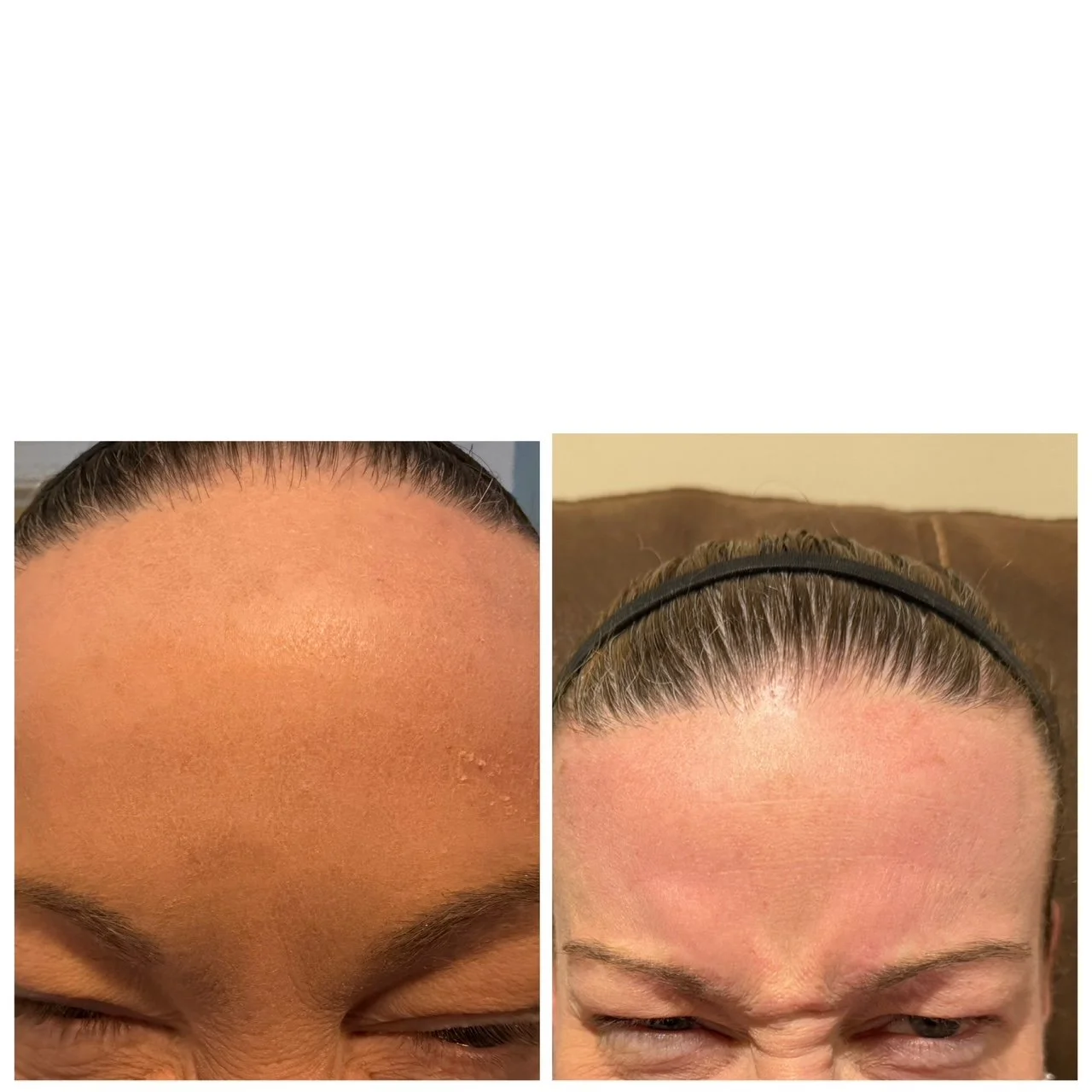 Walpole, WA, 2081 Medspa Near Me.JPG