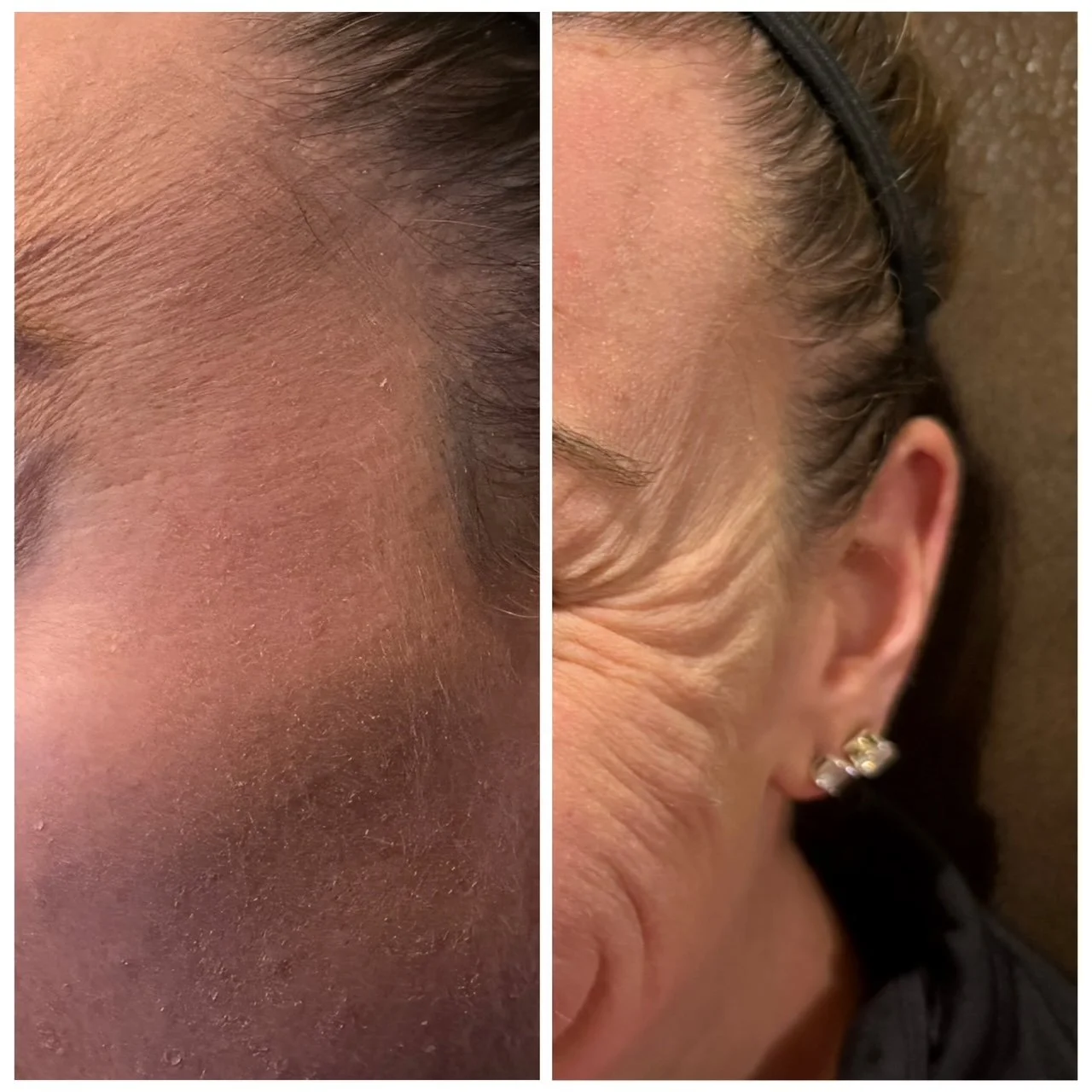 Walpole, WA, 2081, Medspa Near Me.JPG