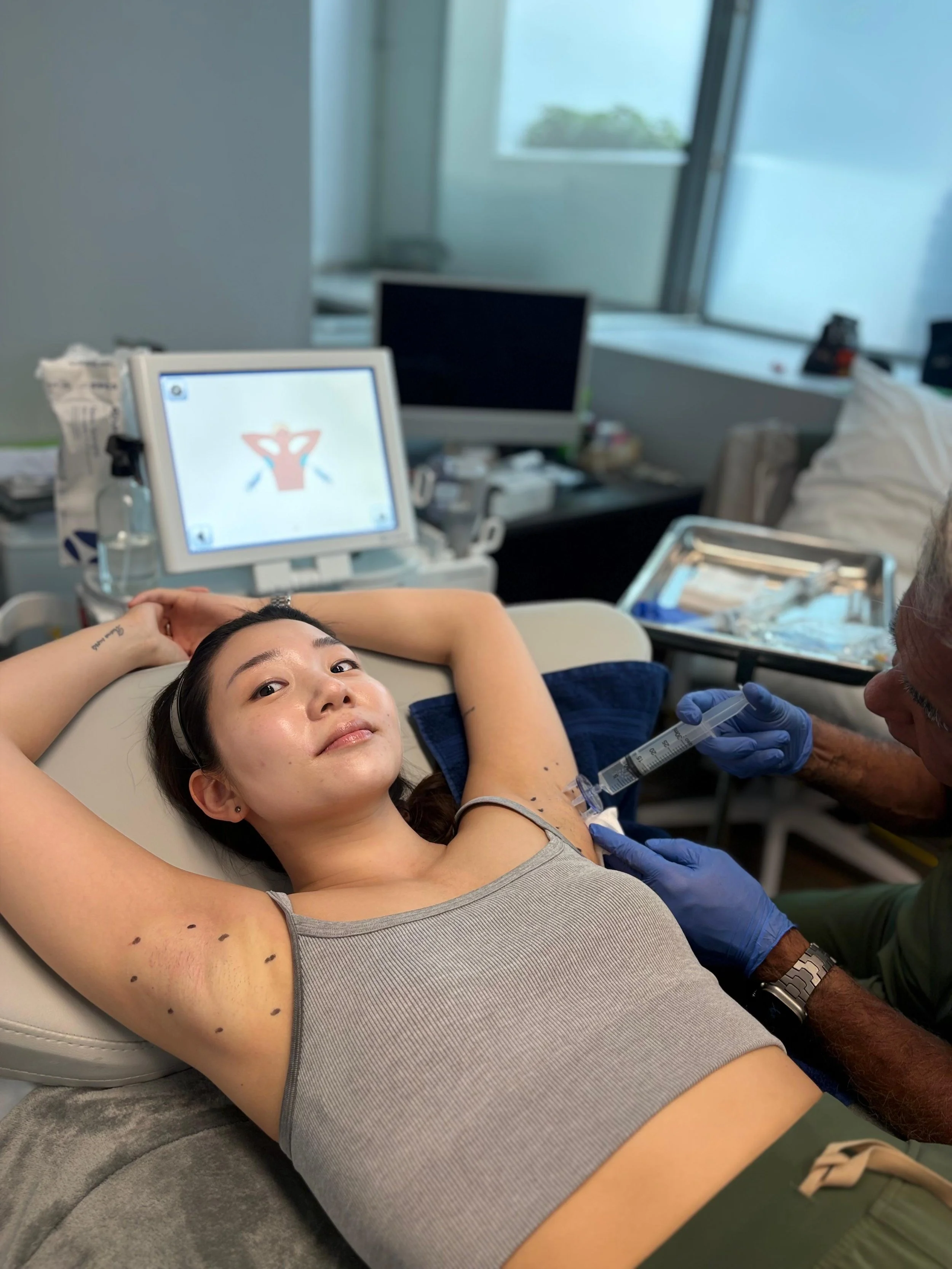 Scarlett during the local anesthetic portion of her miraDry treatment with Dr. Kumar Shivdasani at Phi Skin Clinic in Vancouver, BC.