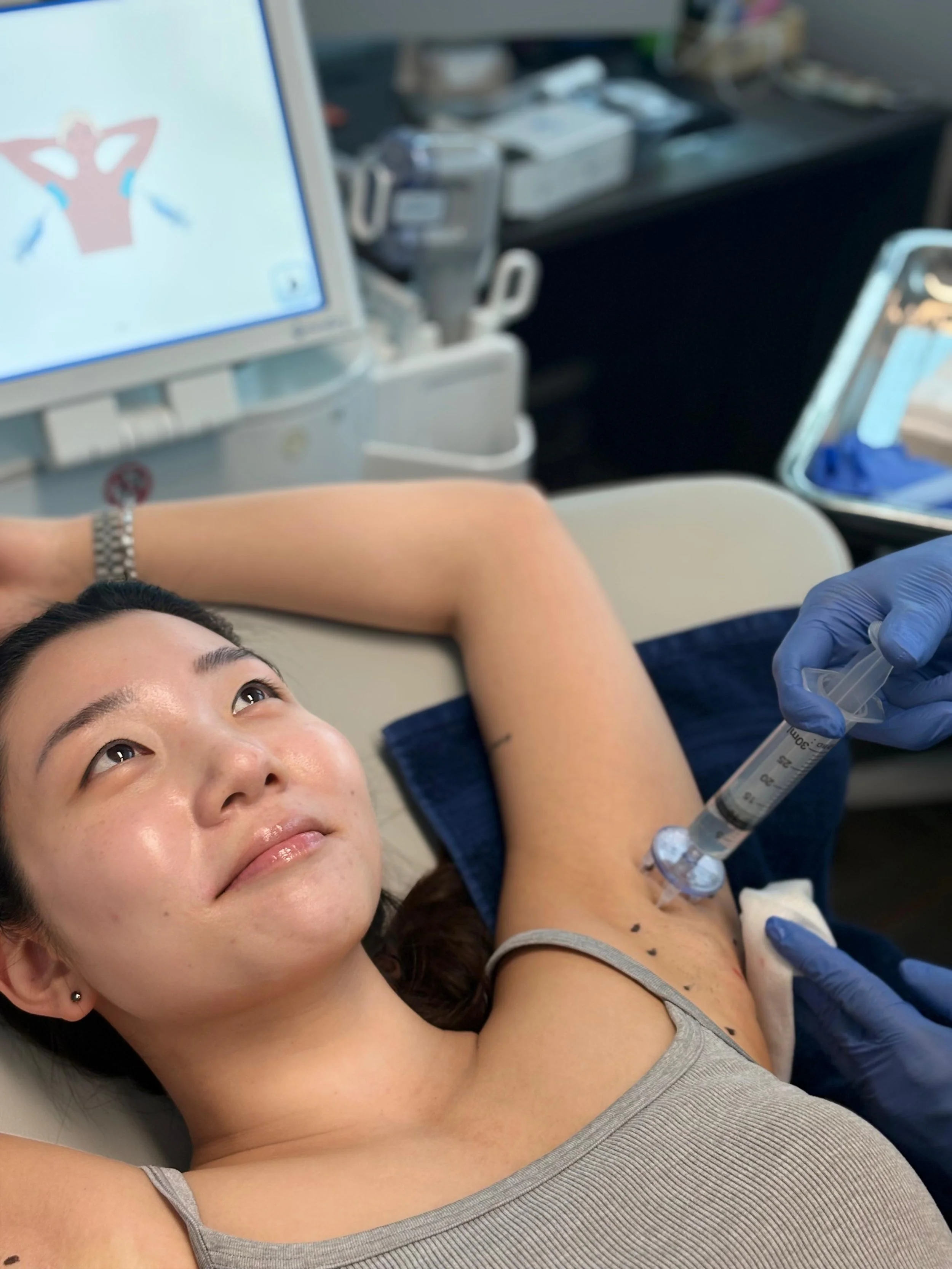 Scarlett receiving local anesthetic before her miraDry treatment at Phi Skin Clinic in Vancouver, BC.
