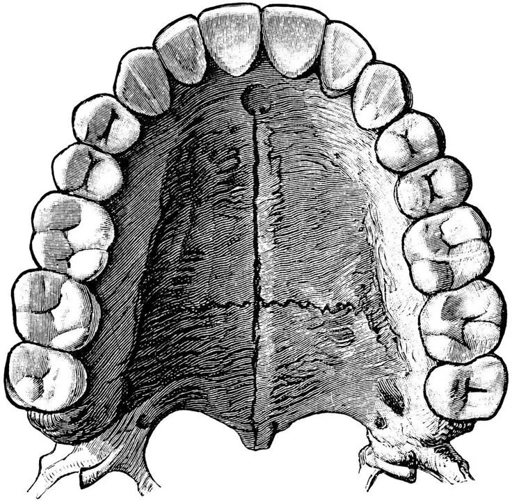 A black-and-white illustration of the upper palate of a human mouth, showing teeth and the hard palate.