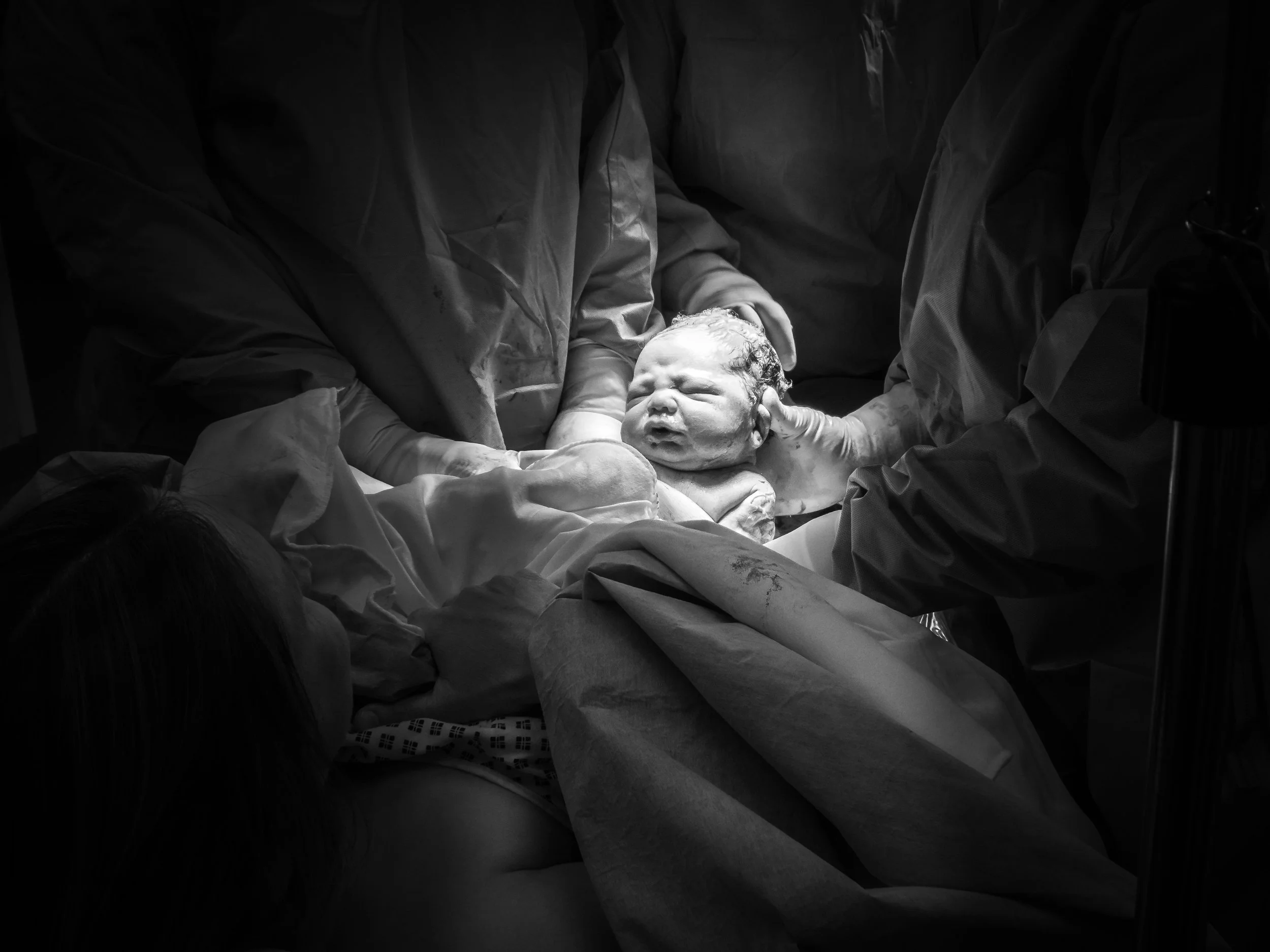 A newborn baby being delivered in a hospital operating room, with medical staff holding the baby and a woman lying on a hospital bed.