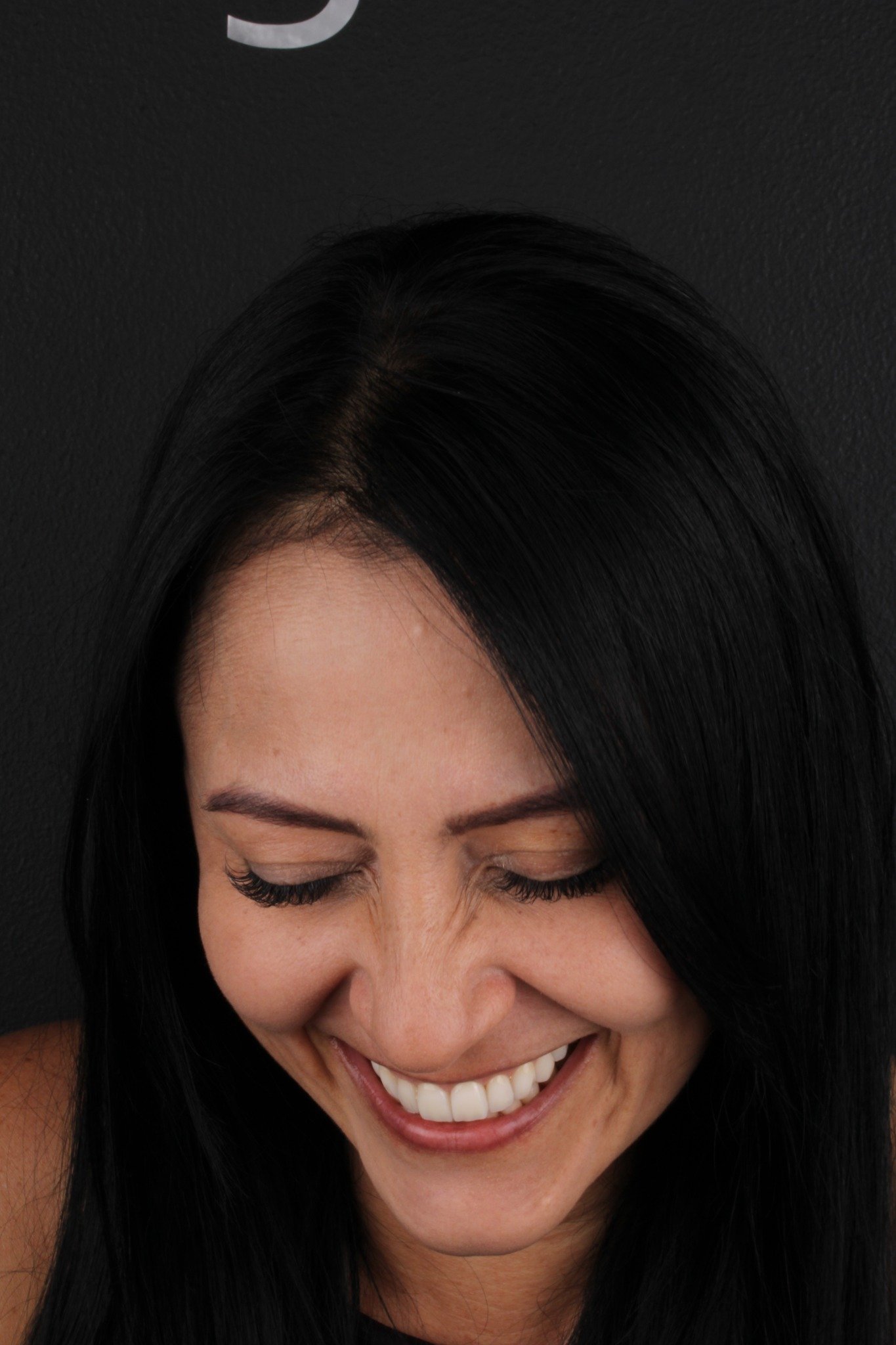 Diseño de sonrisa