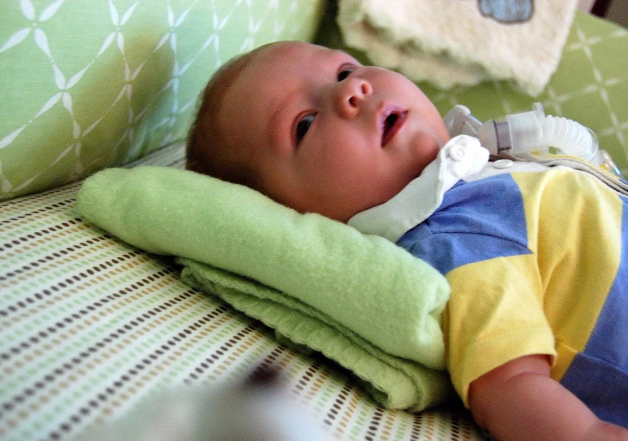 A baby lying on a bed with a green blanket supporting his head, looking up with an open mouth, attached to medical tubes, wearing a yellow and blue shirt.