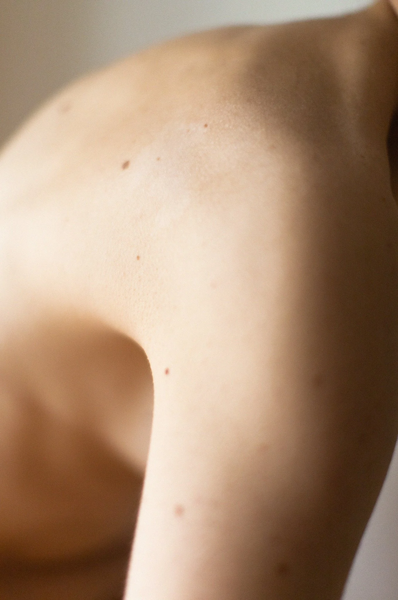 Prise de vue rapprochée de la nuque et du haut du dos d'une personne avec la peau claire, quelques petits grains de beauté.