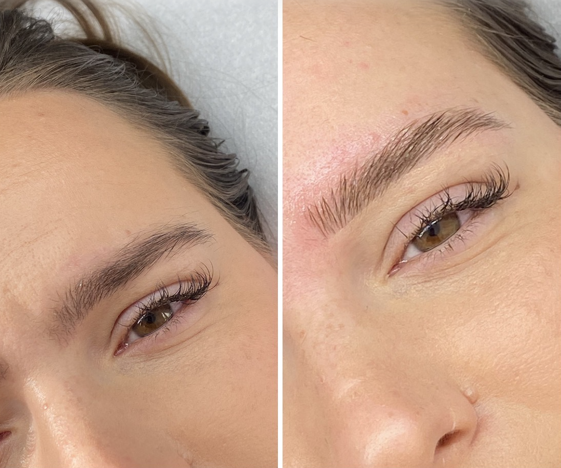Résultat avant/après browlift et restructuration des sourcils à L'Apogée — beauté du regard à Péchabou près de Toulouse.