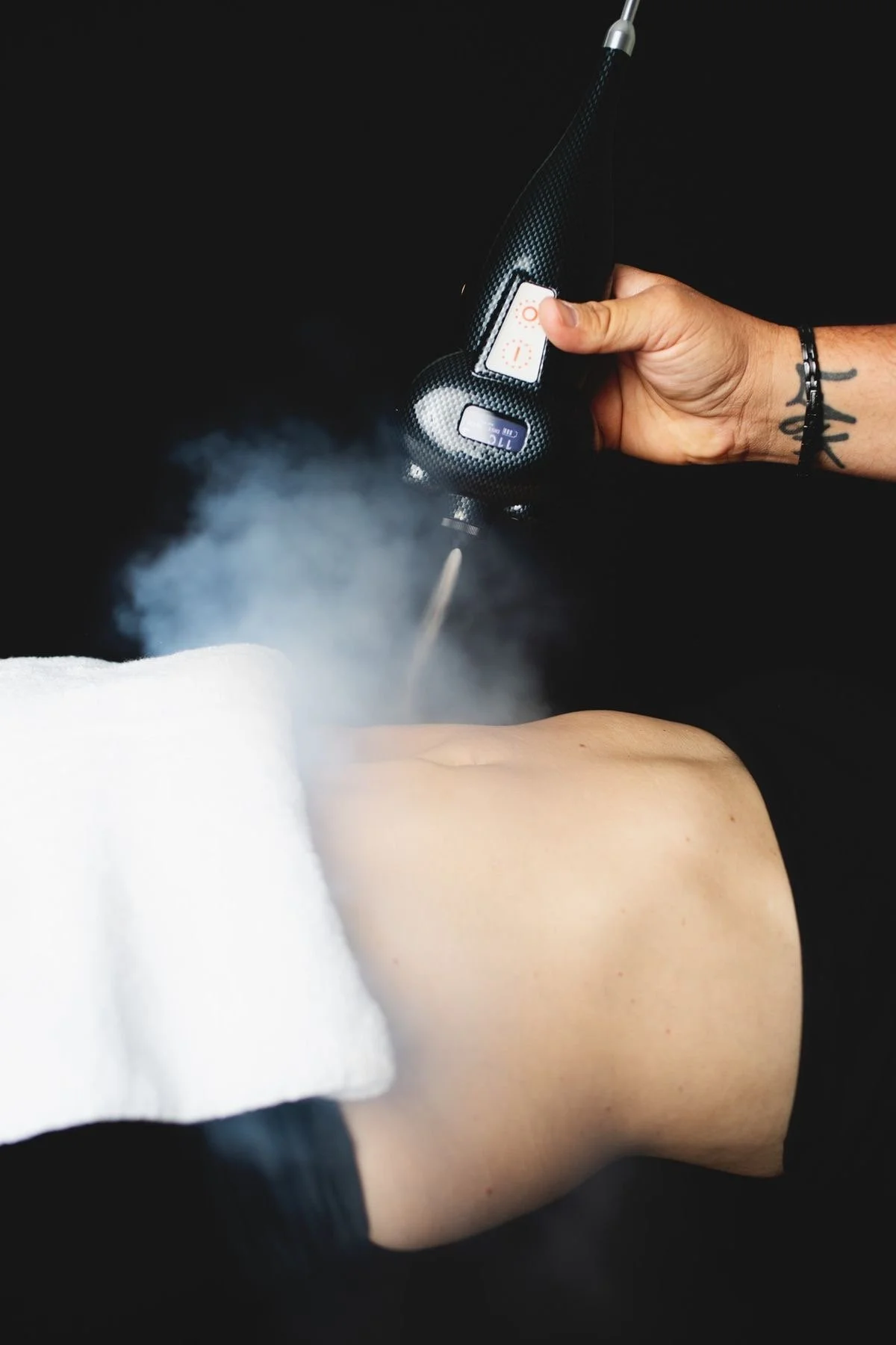 Cryothérapie au CO₂ à L'Apogée — traitement localisé non invasif pour douleurs et remodelage corporel près de Toulouse.