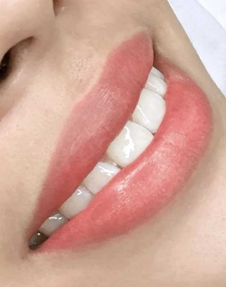 Dark Lips Neutralization