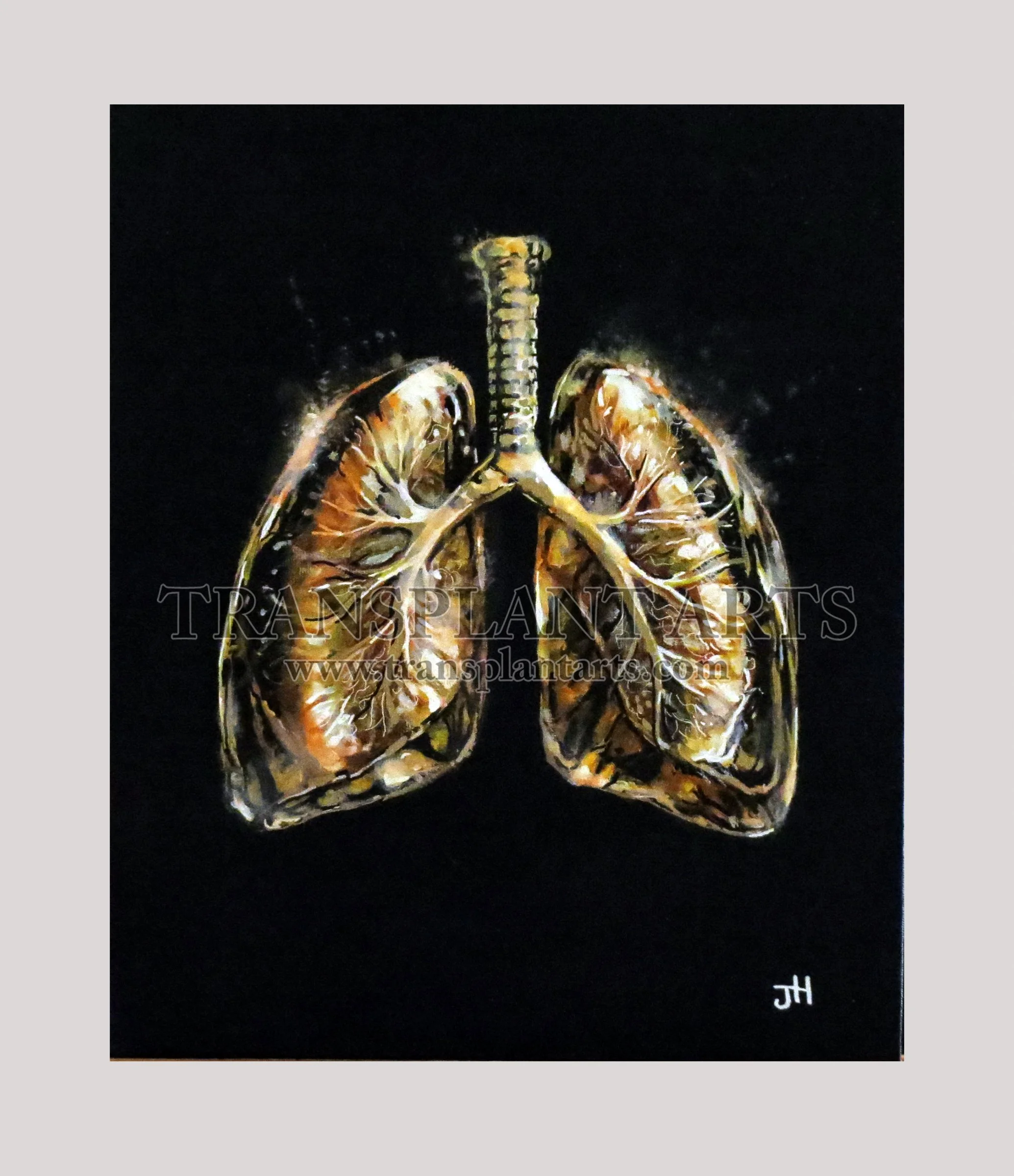 Lungs-transplant-arts-jack-hoyle-watermark.jpg