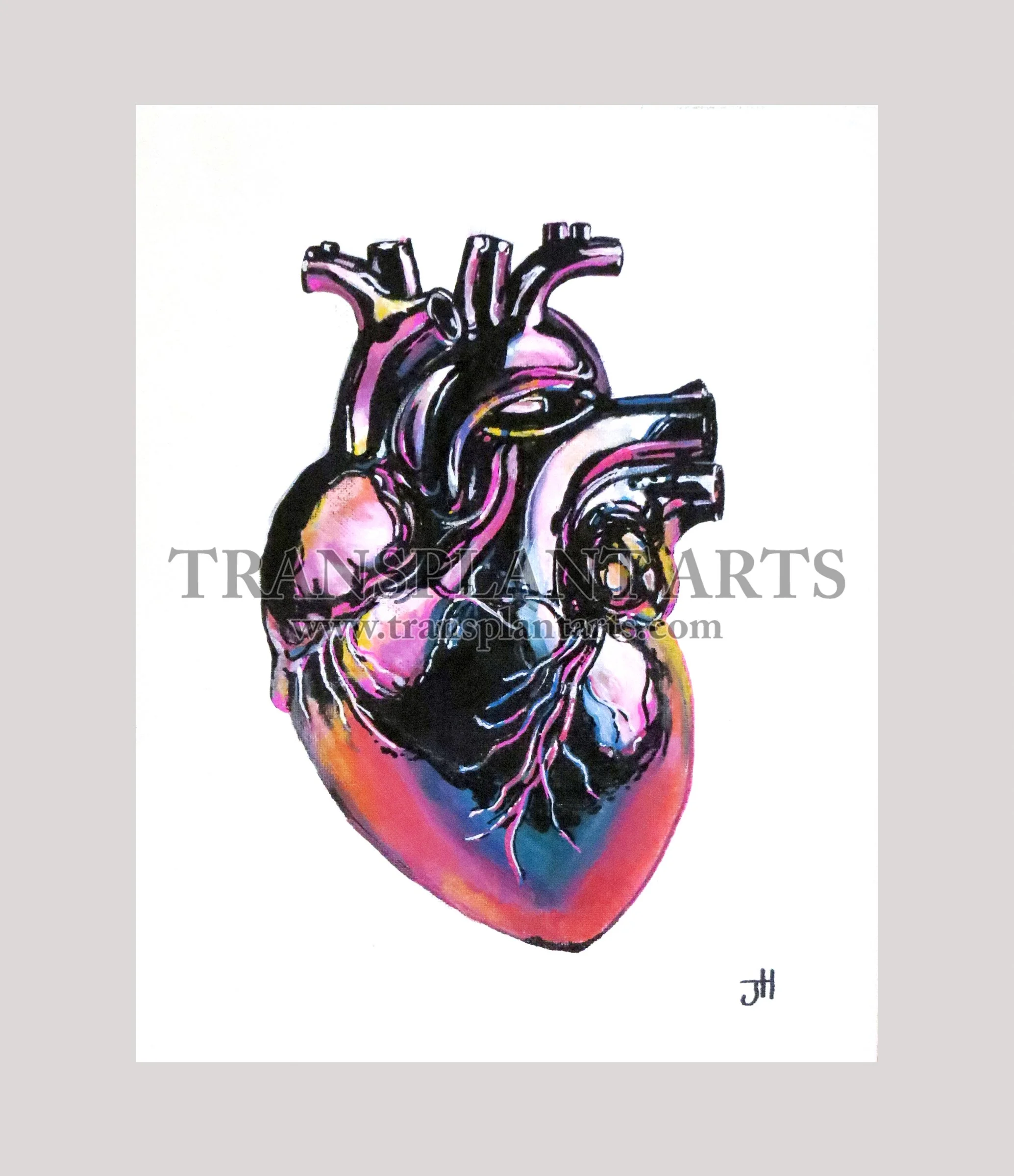 Heart-transplant-arts-jack-hoyle-watermark.jpg