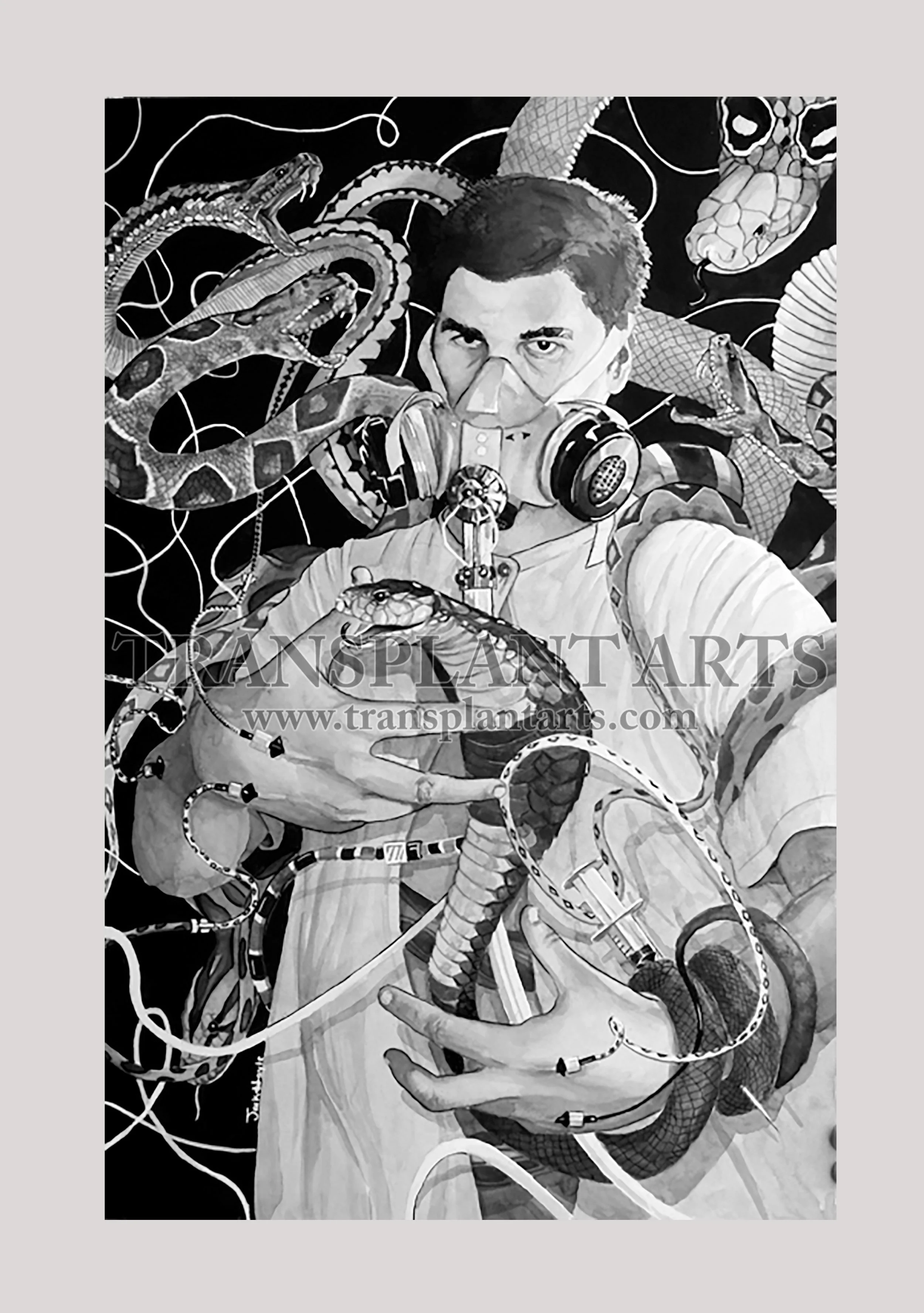 Snake-Bite-transplant-arts-jack-hoyle-watermark.jpg
