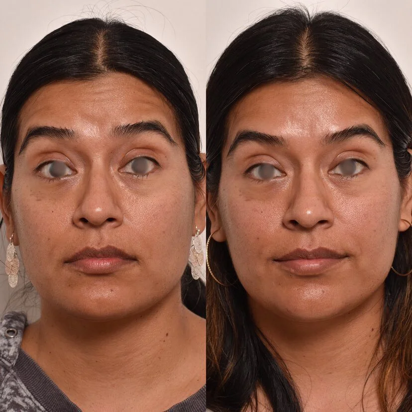 Wrinkle Relaxers