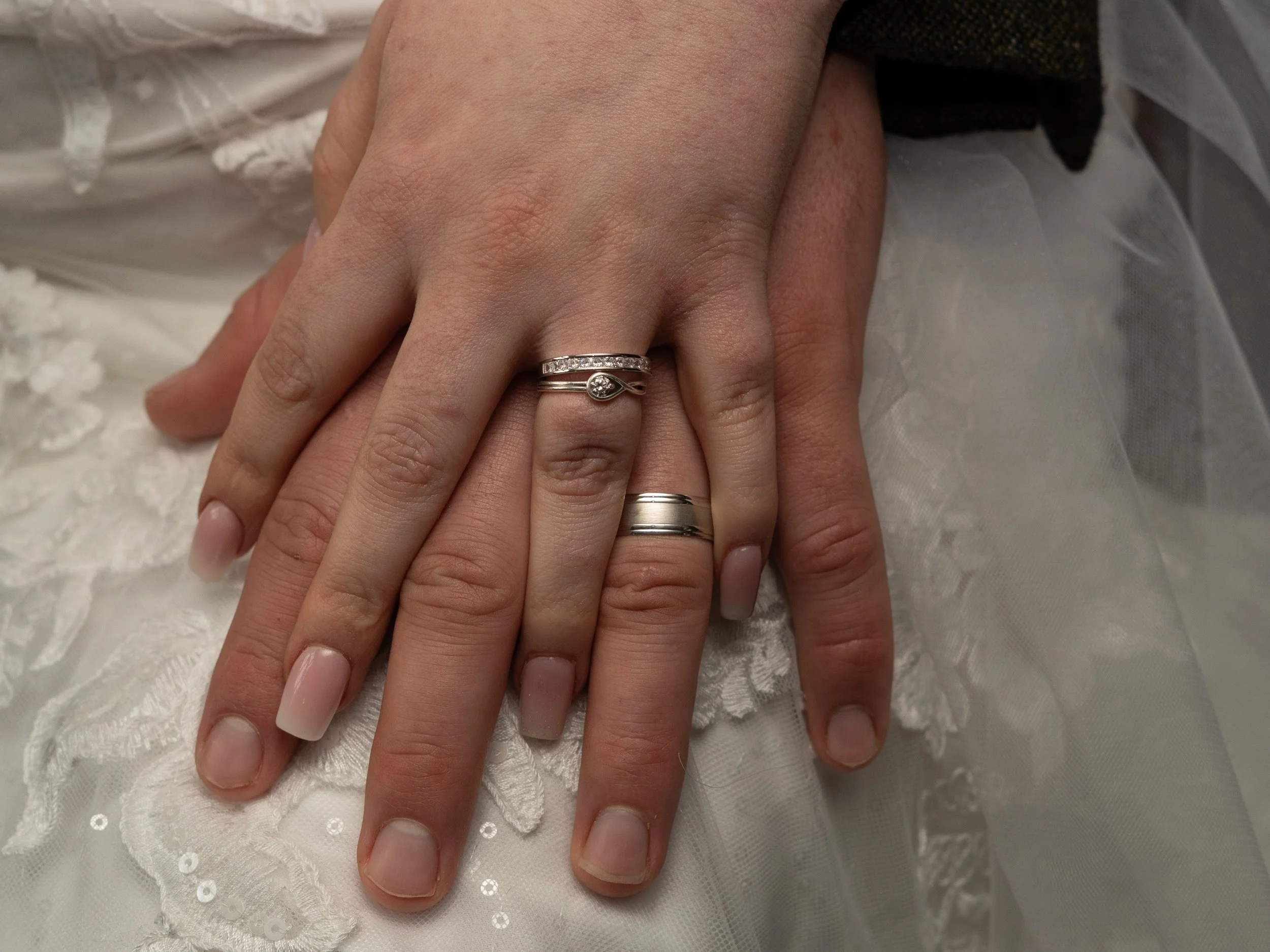Close-up of two hands with wedding and engagement rings, resting on white lace fabric.
