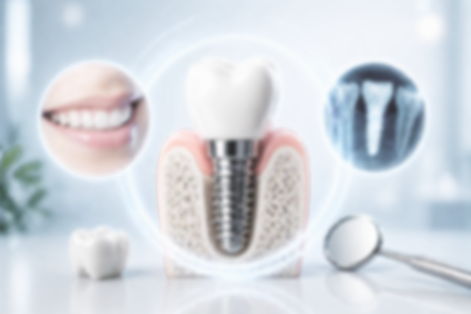 Dental implant replacing missing tooth with titanium implant natural smile restoration Fox Point WI near Mequon Bayside Whitefish Bay